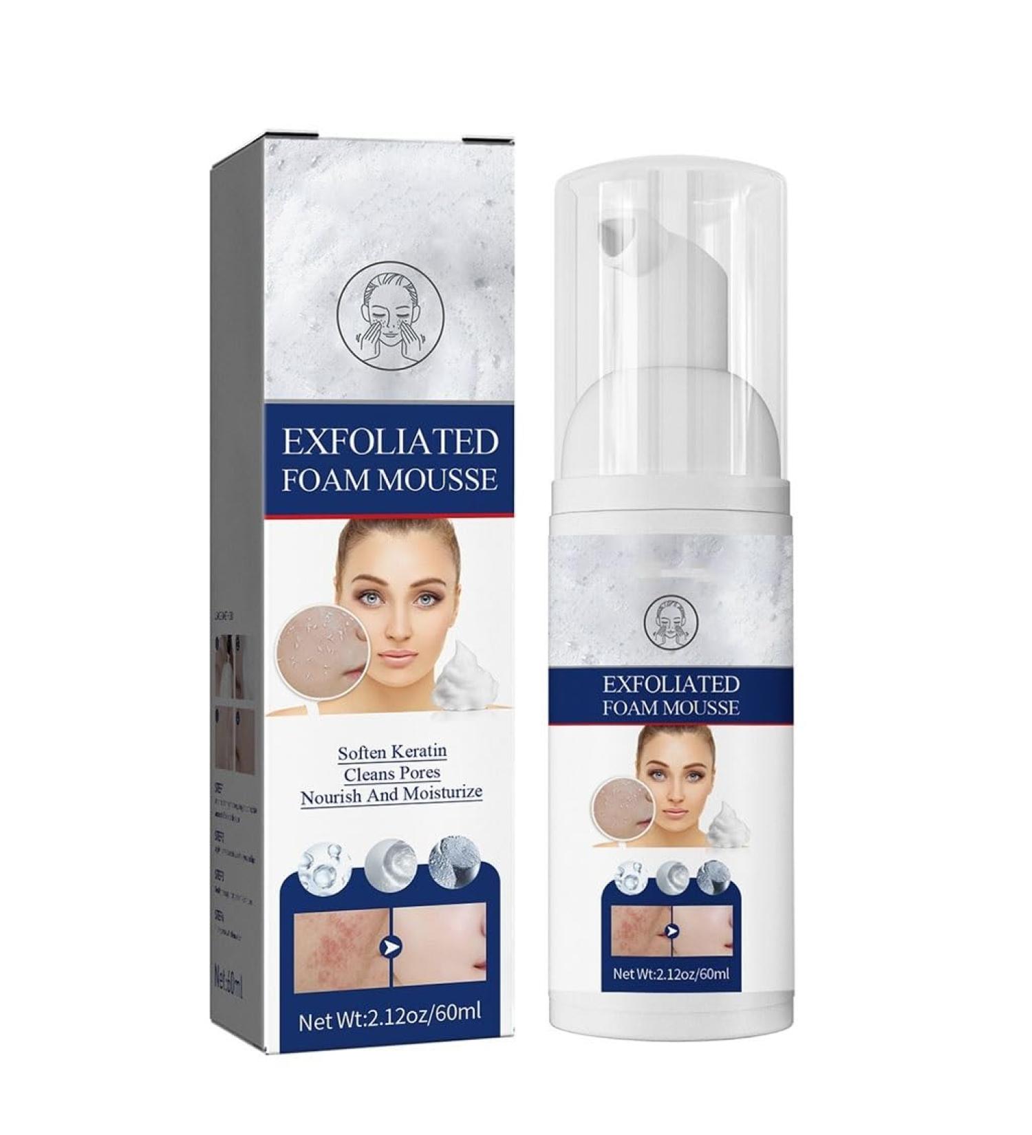 Gentle Exfoliating Mousse - Deep Pore Cleansing Oil Control Blackhead & Dead Skin Removal Acne-Fighting Hydrating Face Cleanser(1PCS) - Buy Online on GoSupps.com