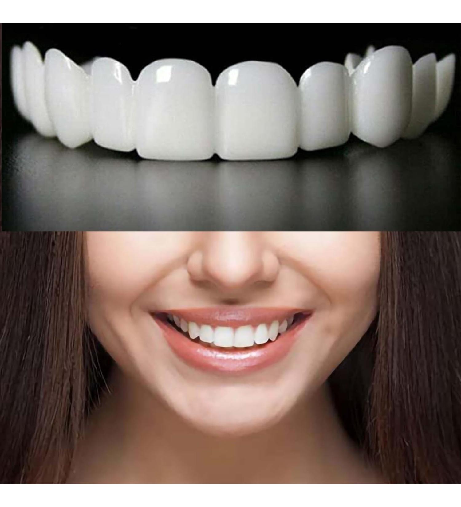 Shop Confident Smile Temporary Cosmetic Solutions for Men & Women - Instant Beauty Boost - Buy Online on GoSupps.com