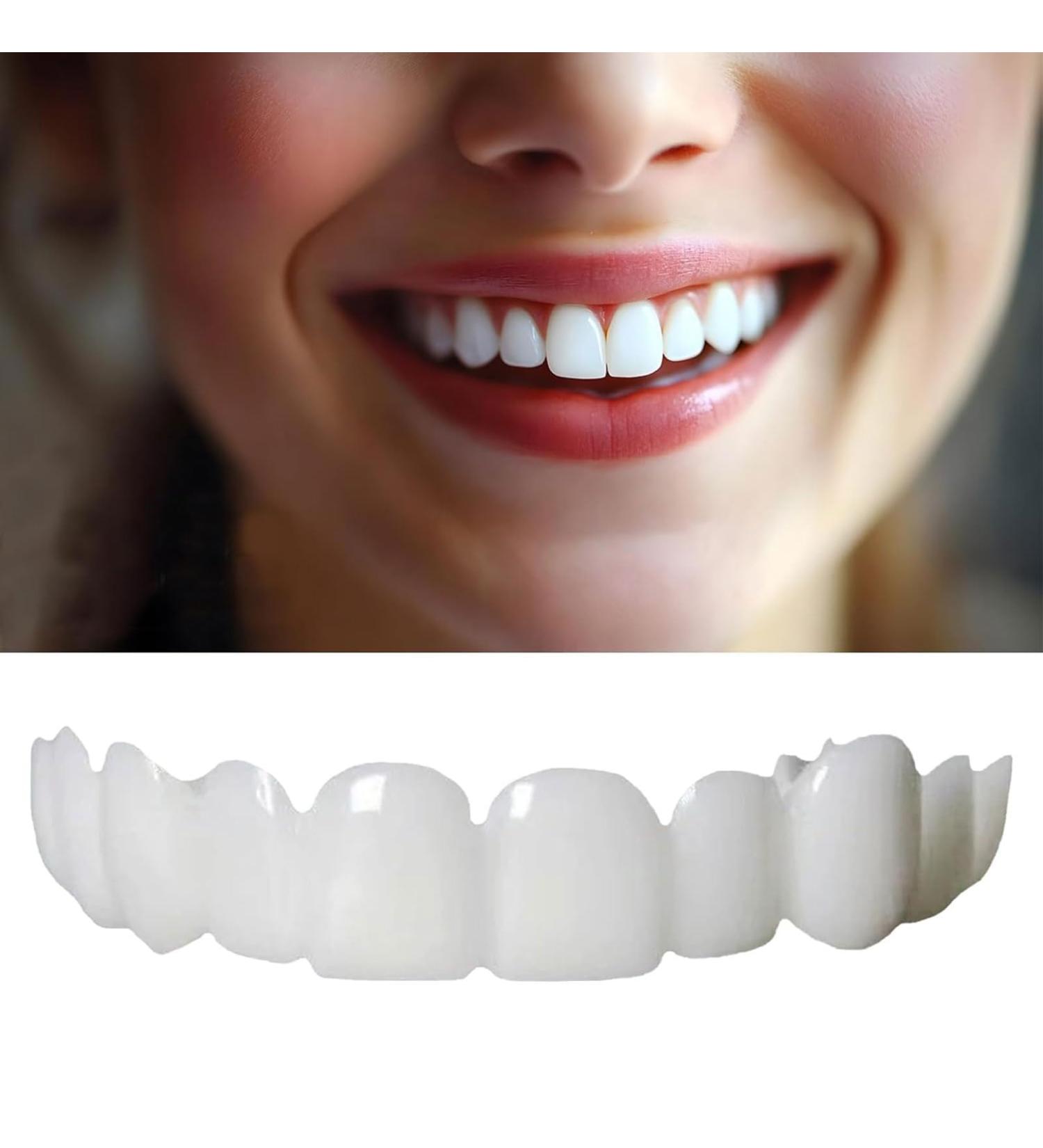 LEOONER 2 Pairs Temporarily Adjustable for Men and Women Nature and Comfortable Regain Confidence Smile - Buy Online on GoSupps.com