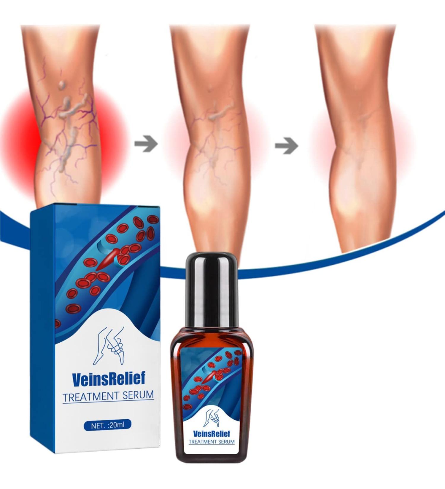 Ambayz Vein Relief Treatment for Varicose Veins - Improve Blood Circulation | 1 Piece - Buy Online on GoSupps.com