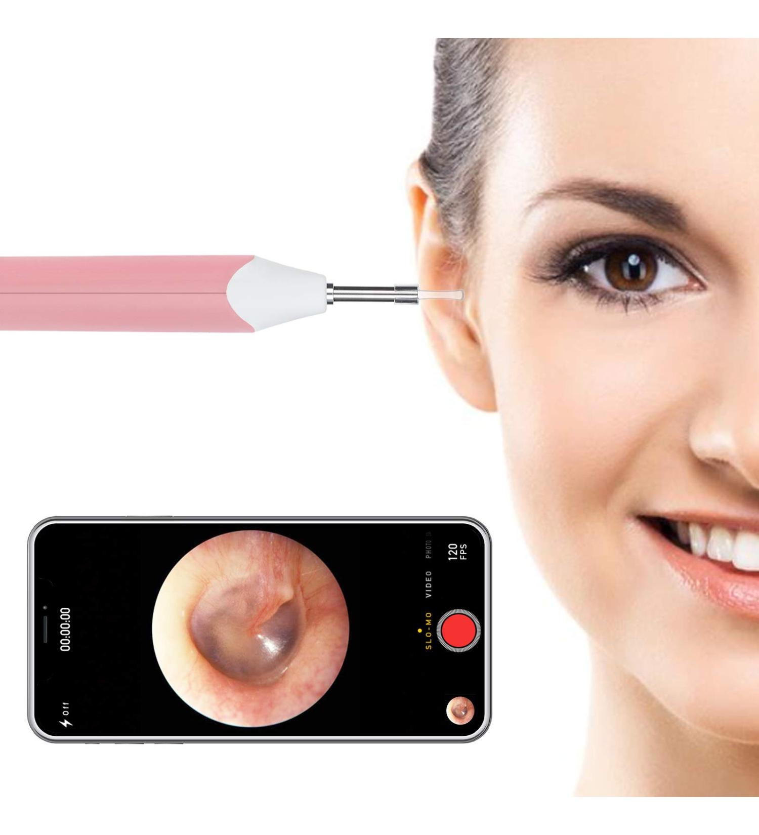 3.9mm Otoscope Ear Endoscope for Ear Wax Removal | 6-Light Ear Inspection Camera HD Waterproof Ear Scope for Kids and Adults | Pink | Compatible with Android iPhone - Buy Online on GoSupps.com