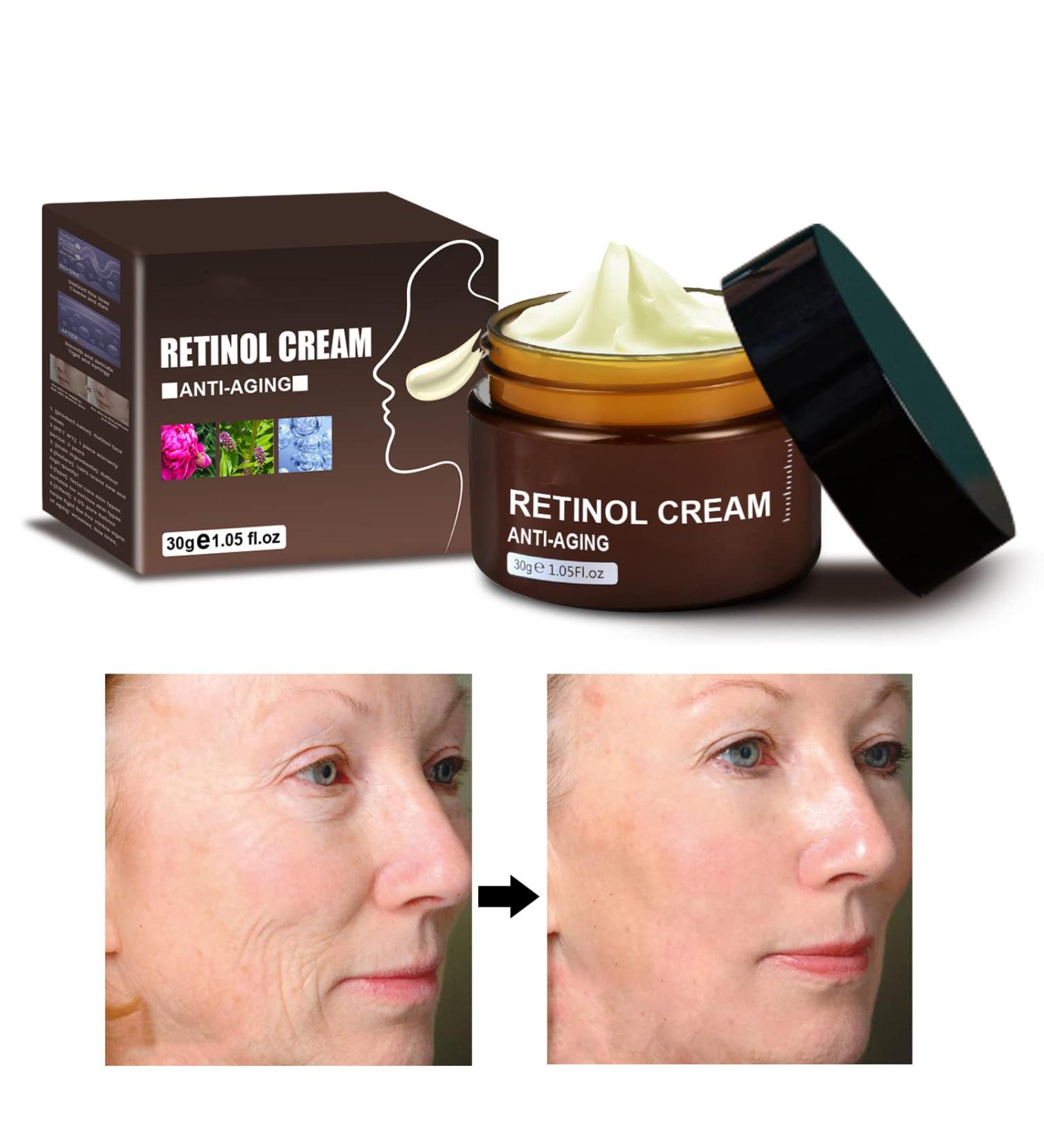 Anti-Wrinkle Face & Neck Retinol Cream with Hyaluronic Acid - Premium Anti-Aging Face Moisturizer - Anti Aging Firming Facial Cream to Reduce Wrinkles Dark Spots Fine Lines Sun Damage - Buy Online on GoSupps.com