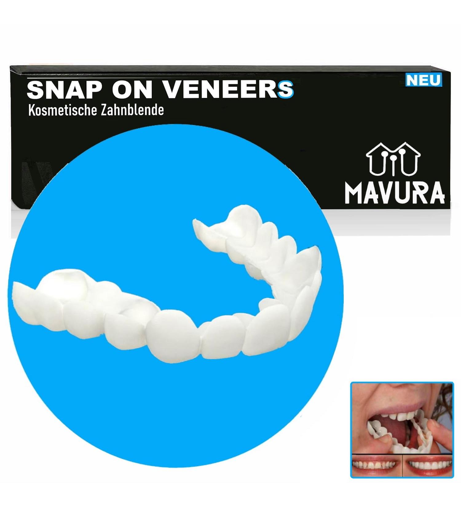 Snap-On Veneers | Comfortable Cosmetic Dental Prosthesis & Flex Dentures for a Perfect Smile - Buy Online on GoSupps.com