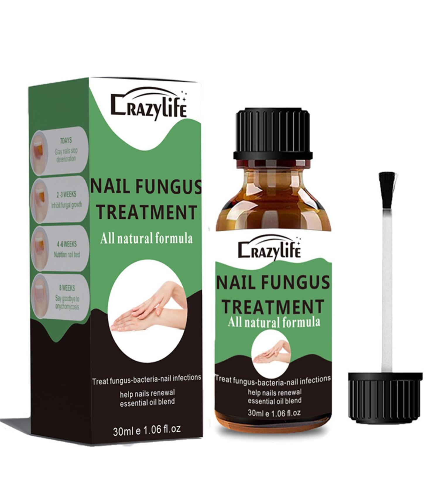 Nail Fungus Treatment for Toenail Extra Strong Nail Fungus Treatment for Toenail and Fingernail Anti fungus Nail Repair and Strengthen Fix & Renew Damaged Broken Nails (30ml) - Buy Online on GoSupps.com