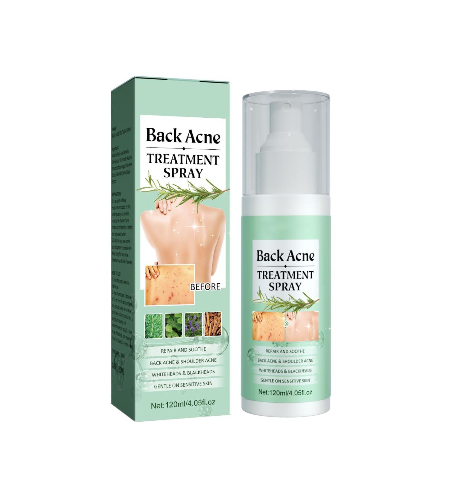 Back Acne Spray - 2% Salicylic Acid & Tea Tree Oil Treatment for Clear Skin | Effective Back & Body Acne Solution for Men & Women - Buy Online on GoSupps.com