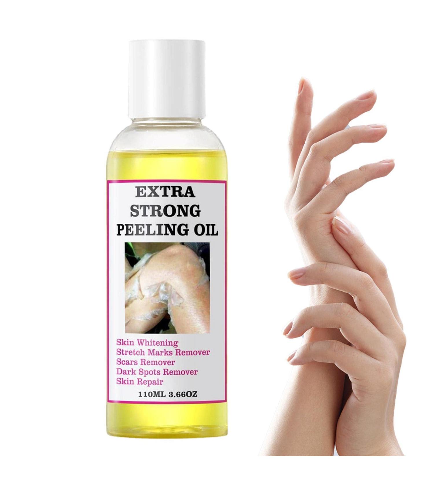 Peeling Oil for Dark Skin skin whitening skin peel for face 110ml Moisturizing Body Exfoliator Peeling Oil Multi-use Black Spot Correcting Oil Skin-friendly Black Spot Remover Brightening Oil - Buy Online on GoSupps.com