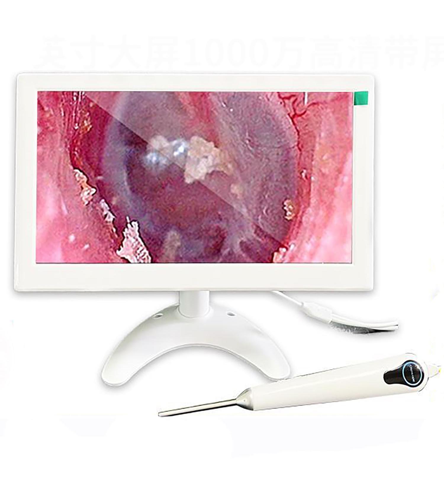 Professional Digital Otoscope Ear Wax Camera - 10 HD Display 3.2mm Lens 10MP Image & Screen Recording - Ideal for Adults | International Shipping Available - Buy Online on GoSupps.com
