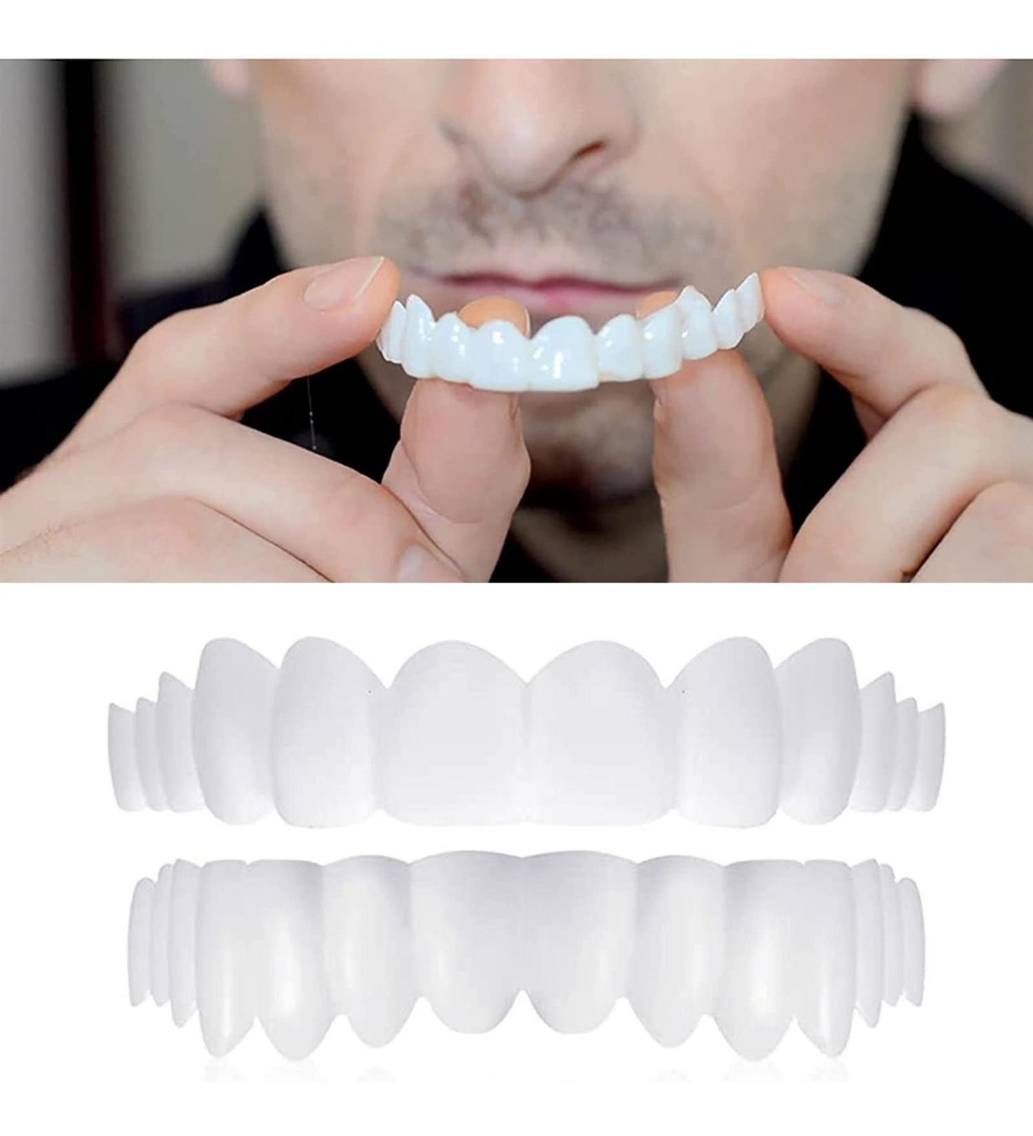 Brigtviee Teeth Veneers - Snap-in Braces for Instant Perfect Smile | DIY Temporary Fake Teeth Kit with Box (2 Pairs) - Buy Online on GoSupps.com