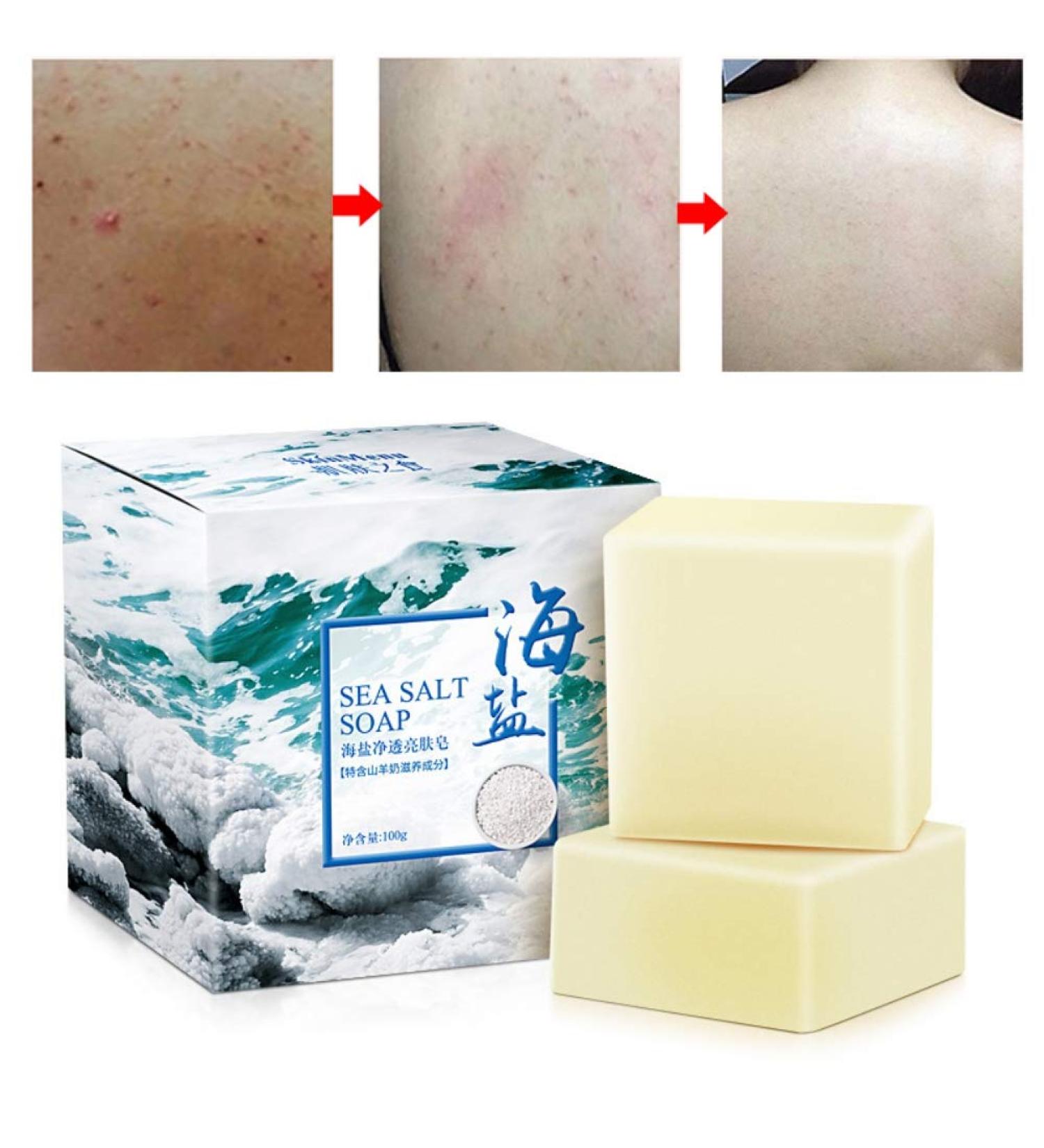 Allbestaye Mite Remove Facial Soap with Sea Salt - 1PC - Repair, Nourish, and Cleanse Quickly - Buy Online on GoSupps.com