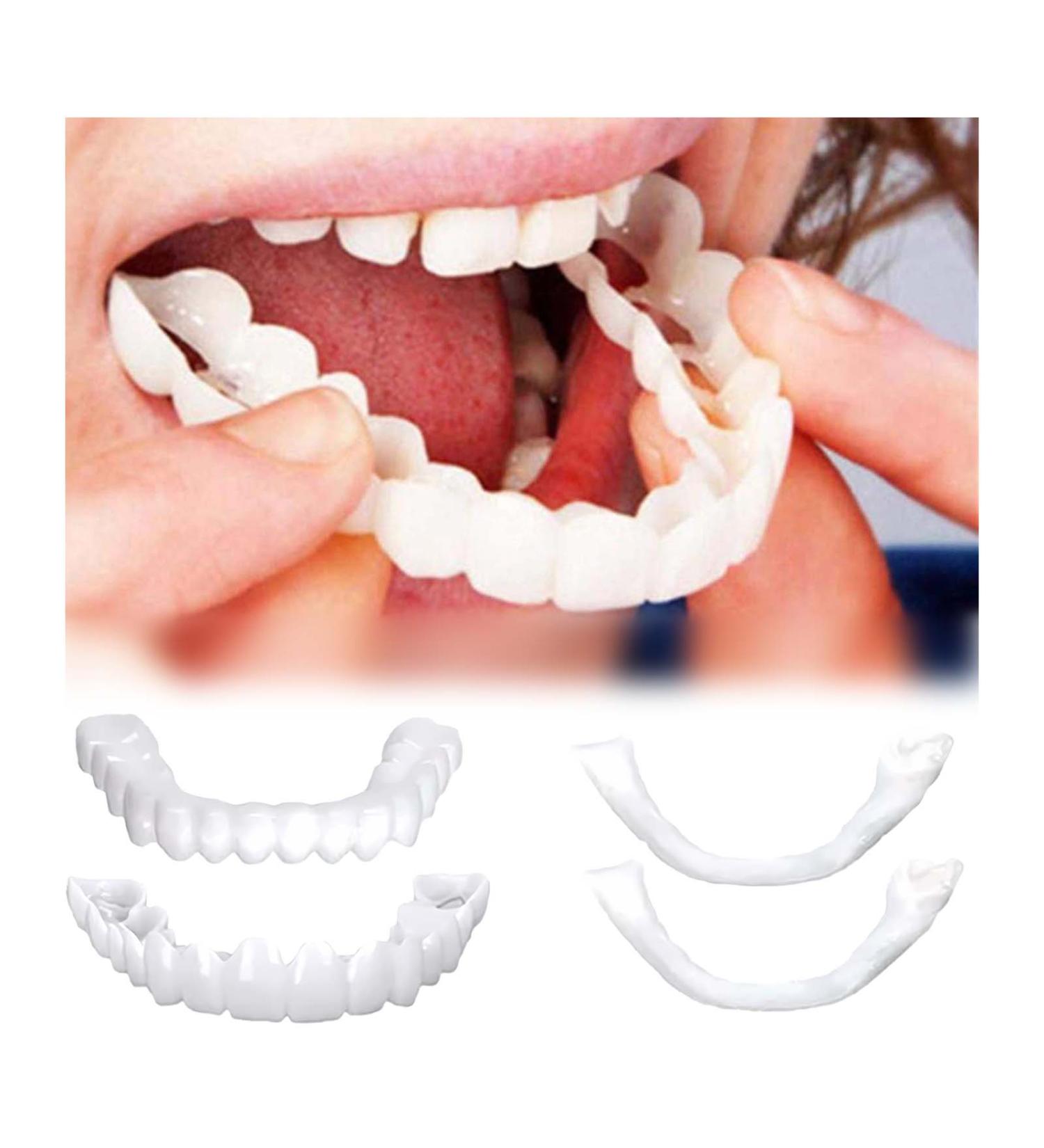 2 Pairs Temporarily Adjustable for Men and Women Nature and Comfortable Regain Confidence Smile(White) - Buy Online on GoSupps.com