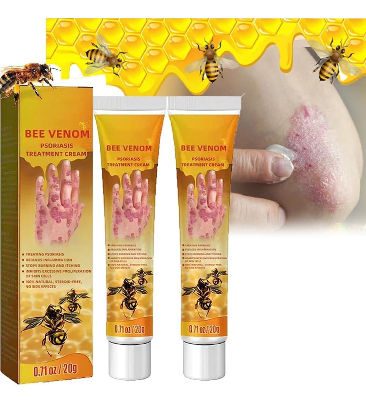 Doxenem Youth Bee Venom Psoriasis Treatment Cream - Soothing & Moisturizing - Buy Online on GoSupps.com