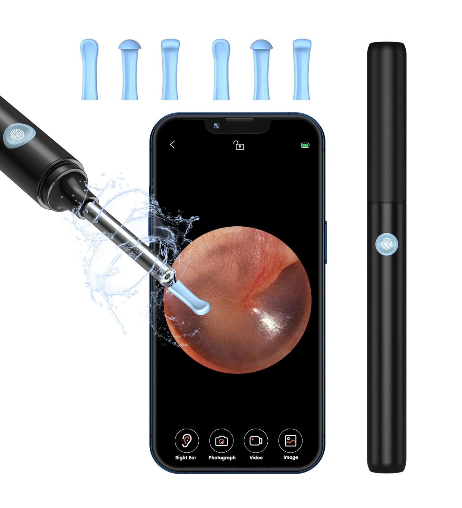 VITCOCO Ear Wax Removal Kit with 1296P Camera - Waterproof Endoscope for iPhone, iPad, Android - Ear Cleaner Tool - Buy Online on GoSupps.com