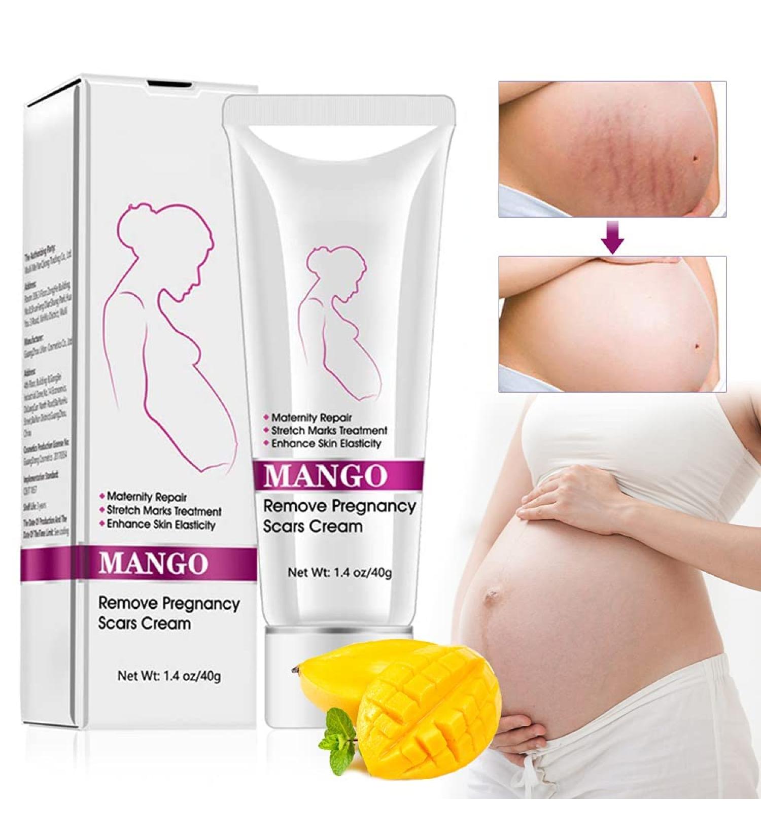 Fengyang Stretch Strips Cream - Best Scar & Stretch Mark Removal Cream for Pregnancy | 40g - Buy Online on GoSupps.com