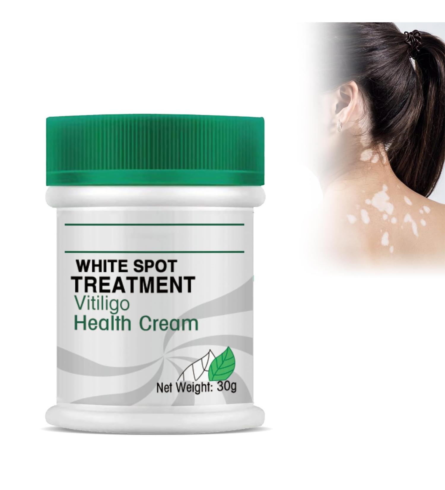  Utapossin Anti-blemish cream delicate herbal extract removes dark spots anti-melanin whitens easy to apply improves skin pigmentation - Buy Online on GoSupps.com