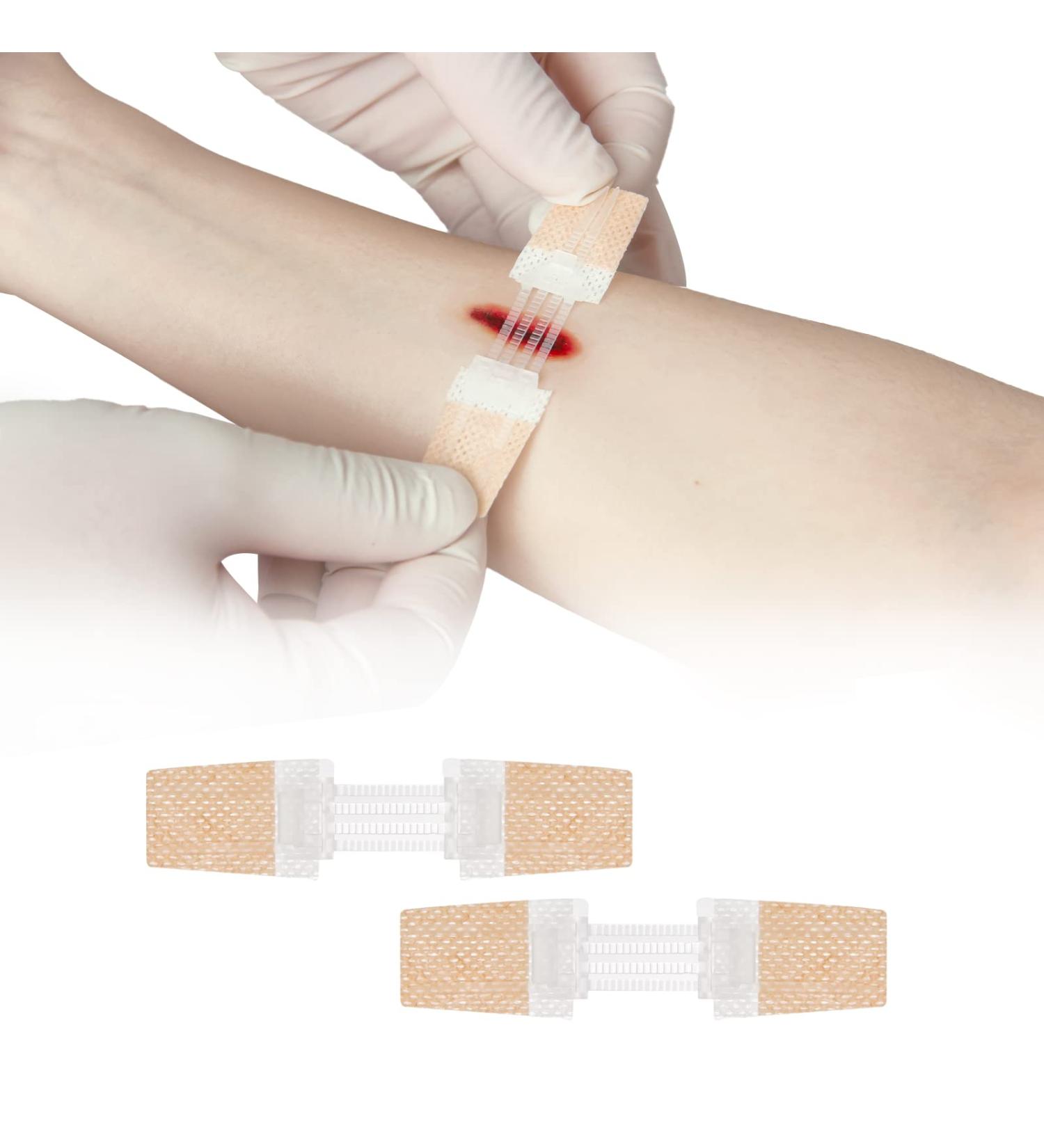 Zip Stitch Laceration Repair - Emergency Wound Closure Device (Pack of 2) - Buy Online on GoSupps.com