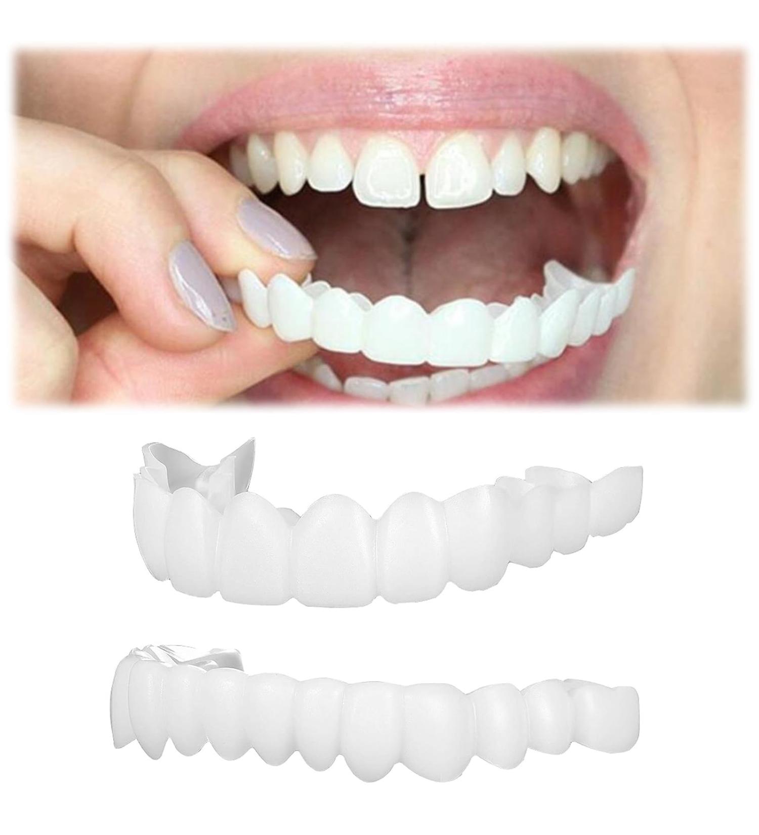 Flipped Warm Cosmetic Veneers for Dentures - 2 Pairs Fake Teeth Set for Men & Women - Top & Bottom Prostheses - Buy Online on GoSupps.com