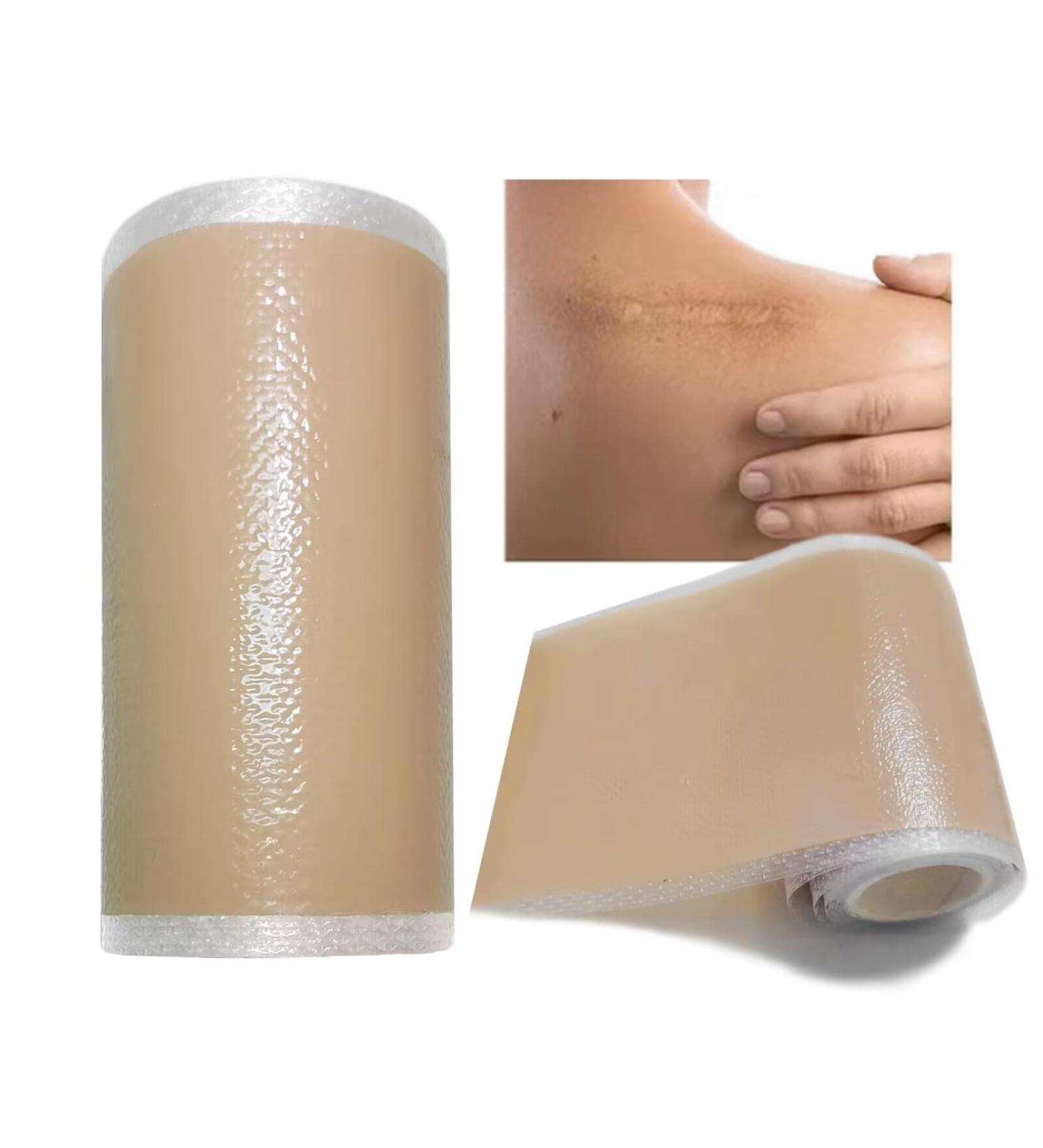 Big Size Silicone Scar Sheets - 3x60'' Roll for Effective Scar Removal | Reusable Silicone Scar Tape for All Types of Scars - Buy Online on GoSupps.com