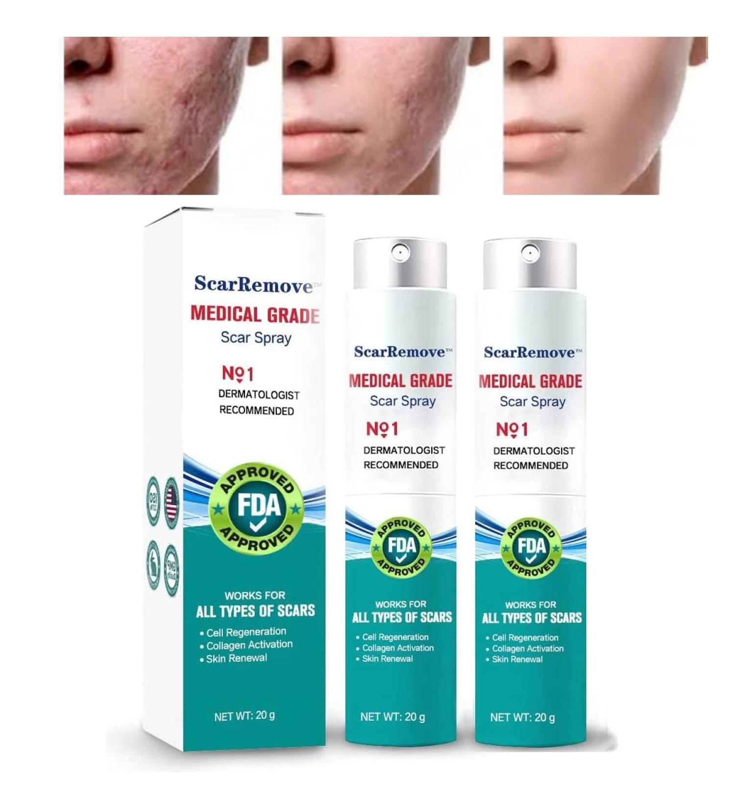 Advanced Scar Spray for Acne, Surgical Scars & Stretch Marks - Gentle Skin Care Treatment for Dark Spots - All Types of Scars Remover - Buy Online on GoSupps.com