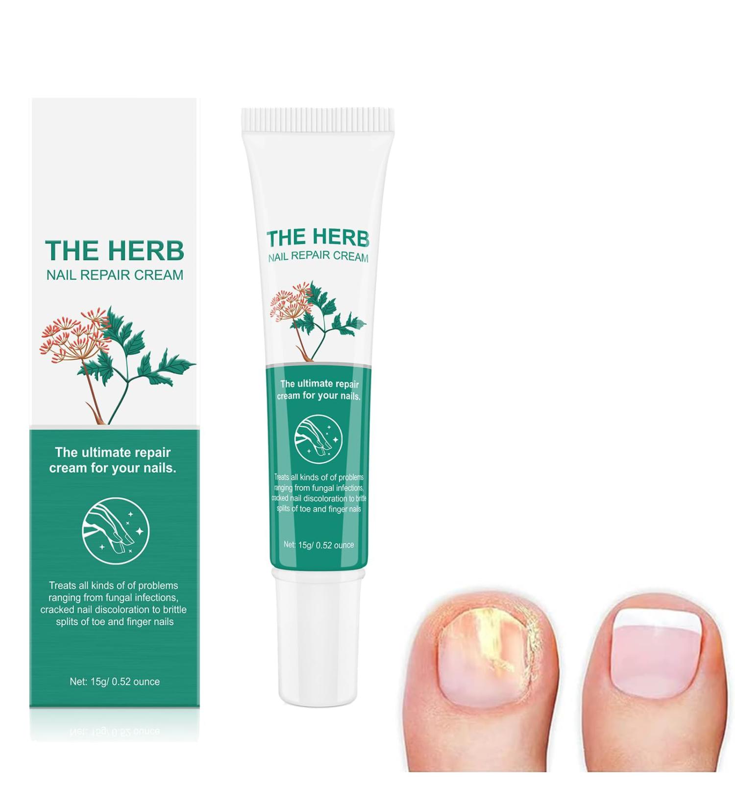 Nail Repair Cream Nail Fungal Treatment Nail Fungal Treatment Fungal Nail Cure Nail Fungus Treatment For Toenail Fungal Nail Treatment Nail Repair - Buy Online on GoSupps.com