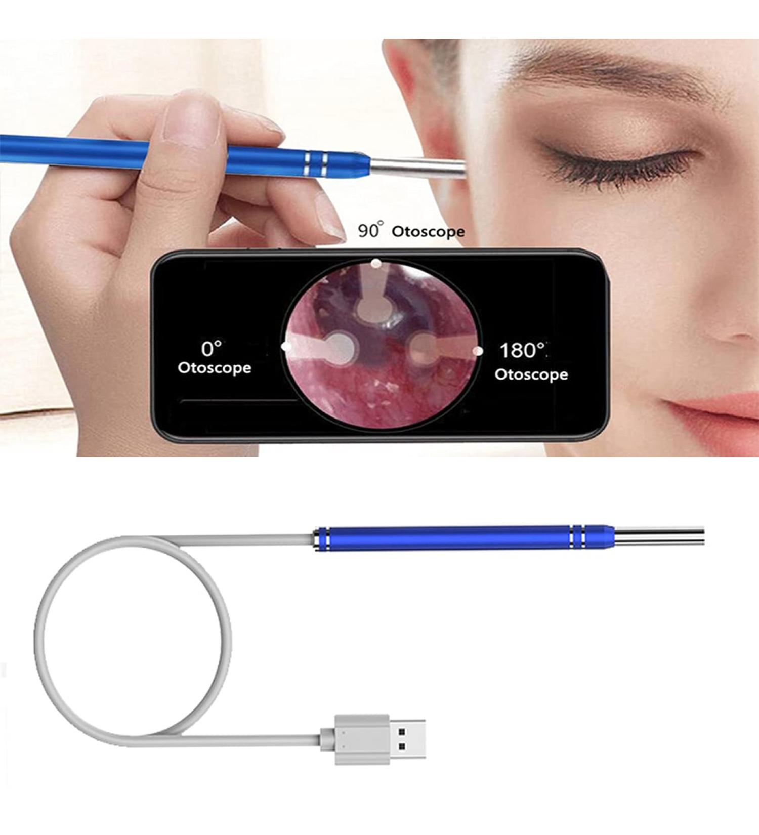 Earwax Removal Tool with Camera and 6 LED Lights - Waterproof Otoscope for Android - Blue - Buy Online on GoSupps.com