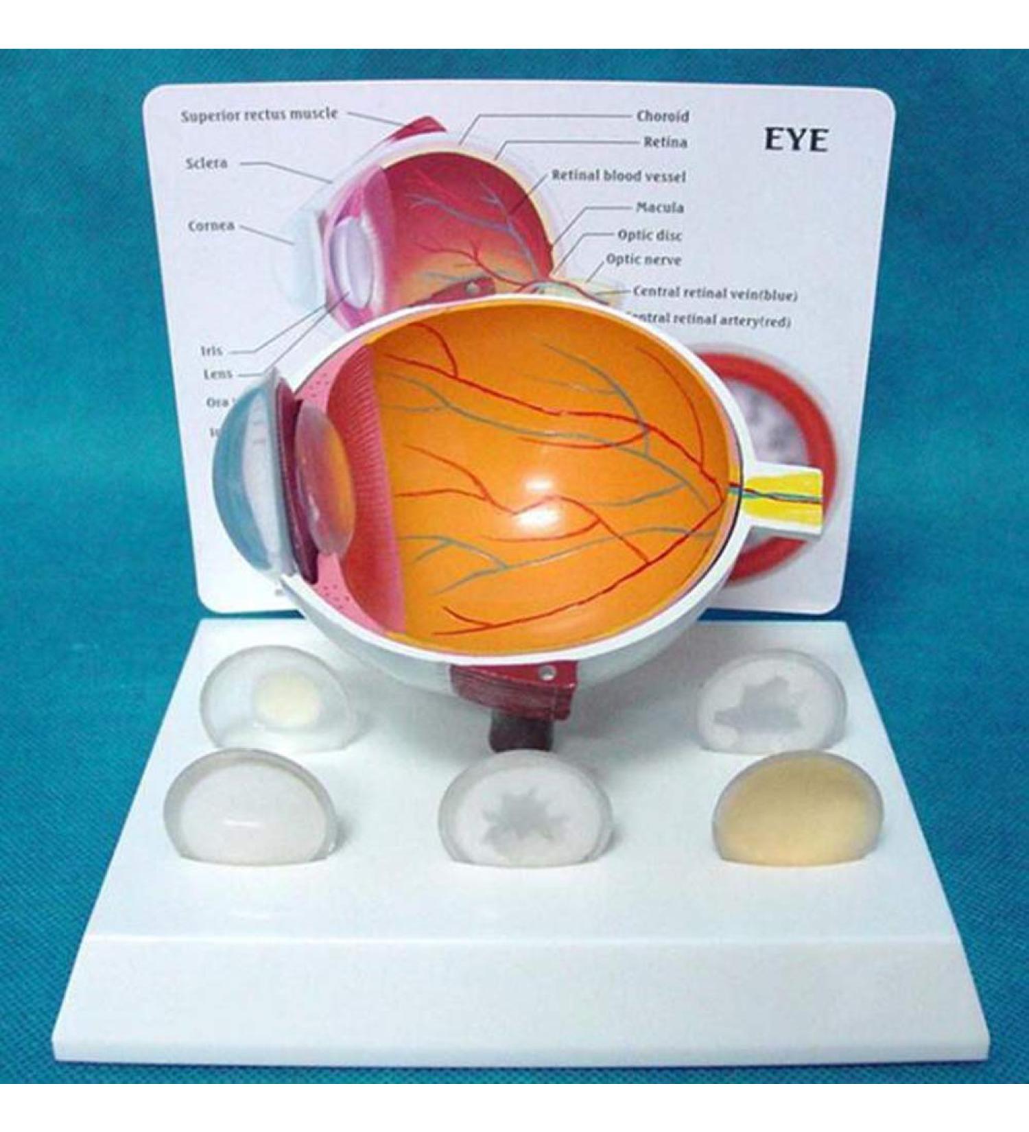 Mod le Anatomies Malade Human Eye Pin Yey Blessure Eye Corn e Cataparakt Eye Mod le Education pour l' cole - Buy Online on GoSupps.com