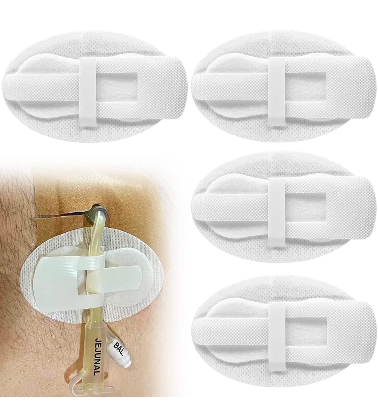 Catheter Stabilization Device - Pack of 5 | PD Dialysis Patch for Feeding Tube & Drain | G-Tube J-Tube Peritoneal Dialysis Accessories | Adhesive Bandages Included - Buy Online on GoSupps.com