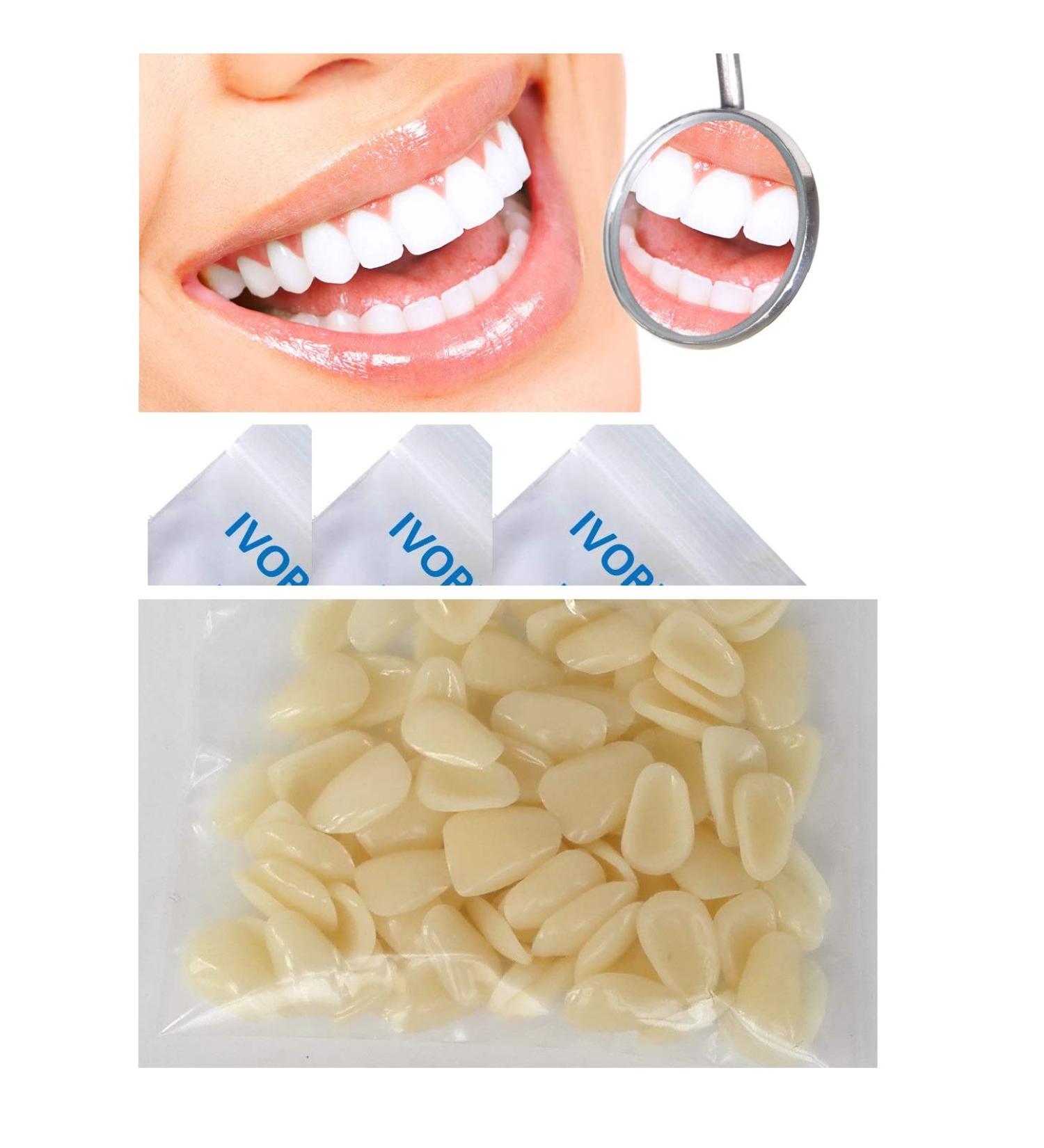 Cosmetic Dental Componeer Thin Whitening Resin Veneer Upper Anterior Teeth 50-Pcs (A2 shade)