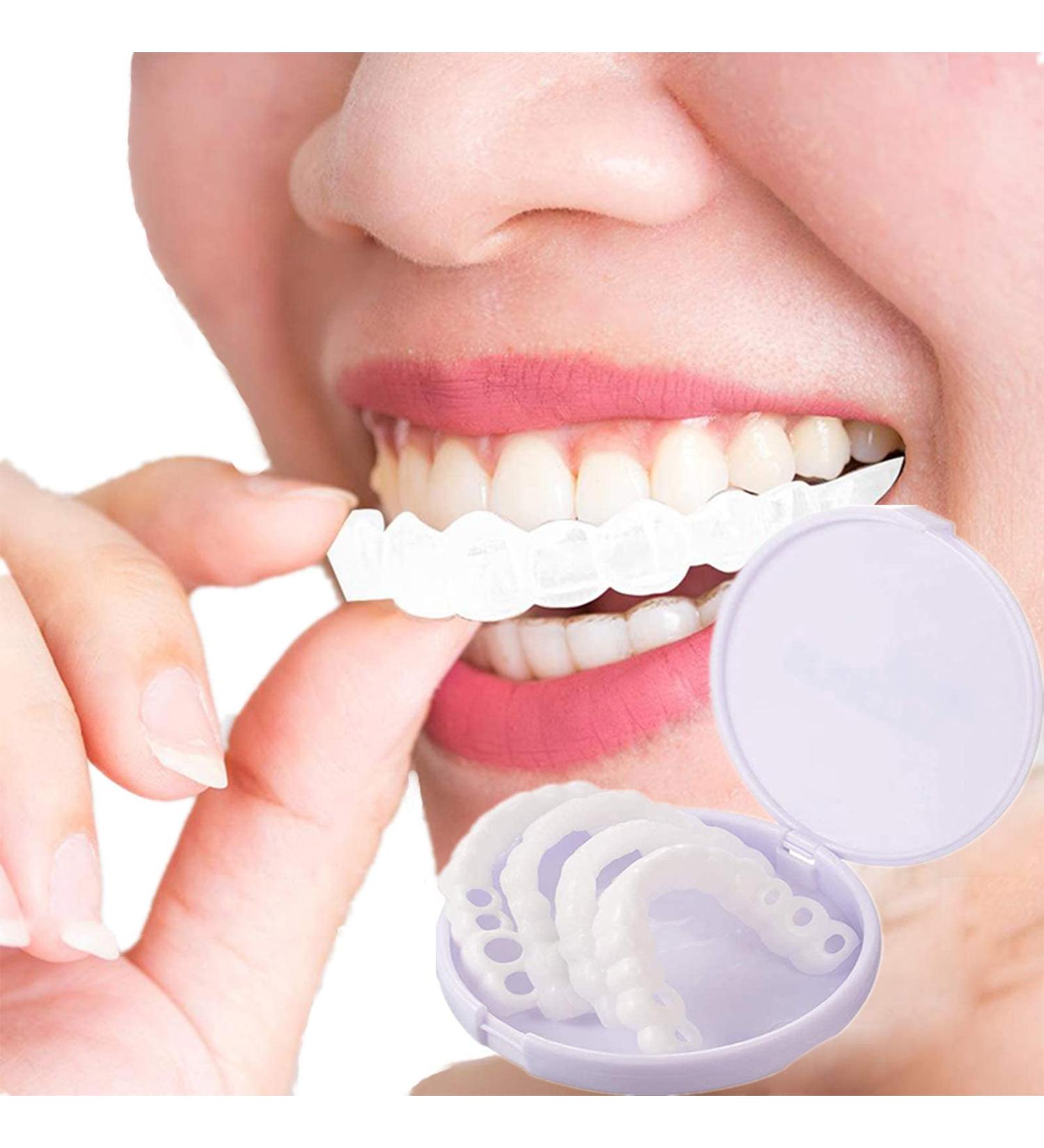BrightView False Teeth Veneers - 2 Pairs Cosmetic Tooth Covers | Temporary Dentures & Artificial Teeth for Men & Women - White Prosthesis with Storage Box - Buy Online on GoSupps.com