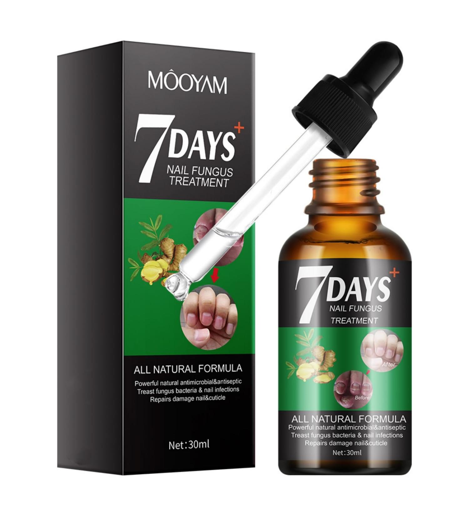 Premium Ginger Cuticle Oil - Nail Strengthener & Turmeric Growth Serum for Damaged Nails | Nourishing Non-Sticky Formula - Buy Online on GoSupps.com