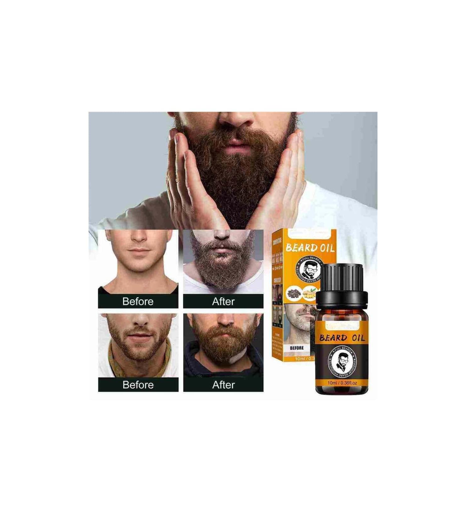 Beard Care Essential Oil & Growth Balm | 100% Natural Ingredients | Perfect Gifts for Men - Buy Online on GoSupps.com