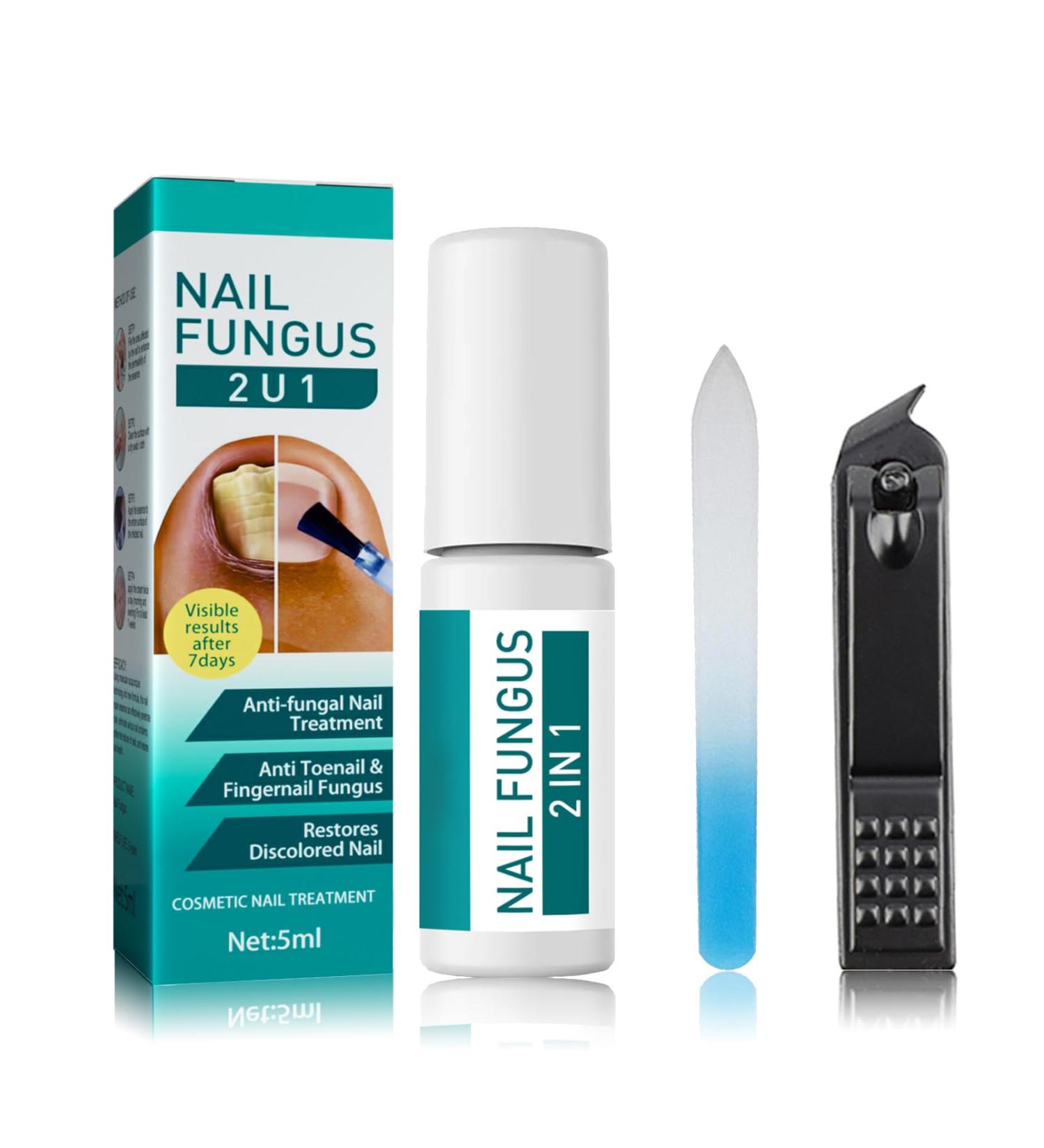 Anti-Fungal Nail Treatment Kit with Nail Clippers & Glass Nail File - Natural Ingrown Toenail Correction & Fungal Nail Repair - 2 in 1 Nail Care Solution - Buy Online on GoSupps.com