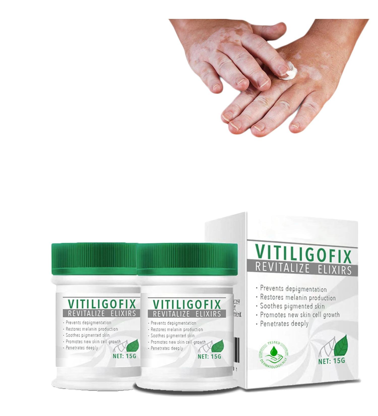 VitiligoFix Revitalize Elixir: Psoriasis Relief Cream & Moisturizer for Skin, Natural White Spot Remover (2Pcs) - Buy Online on GoSupps.com