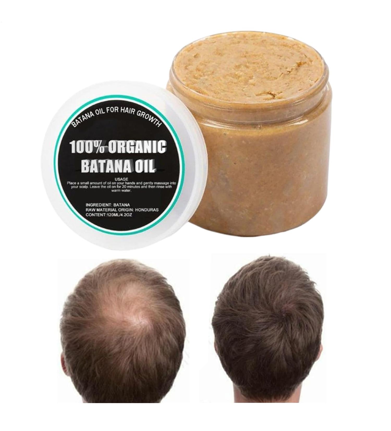 Hair Thickening Oil 120ml Intensive Moisturizing Cream Firming Scalp Massage Oil - For Women Girls Mothers Fathers Grandmothers and Wives - Buy Online on GoSupps.com