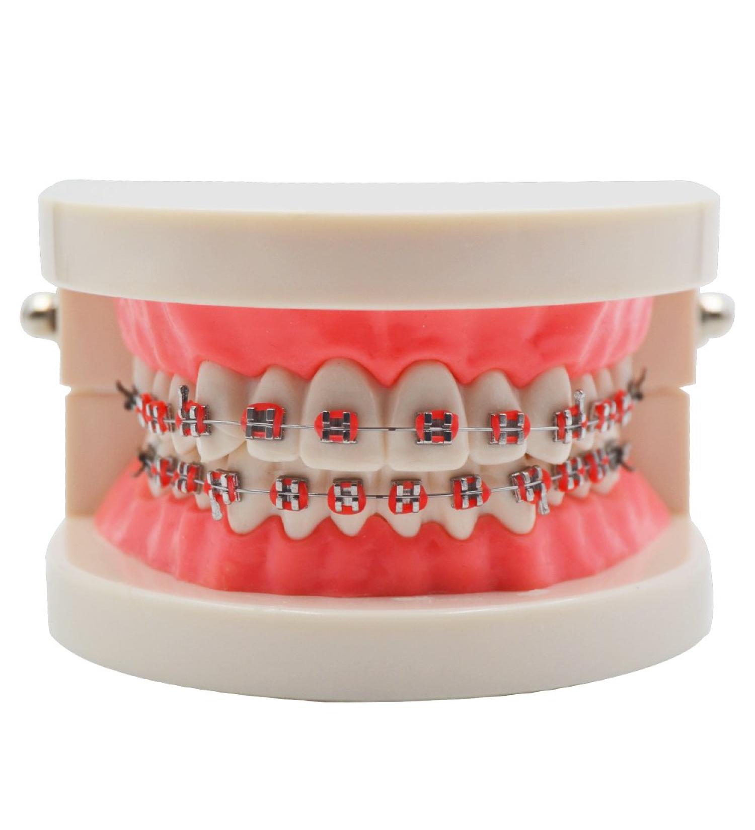 Standard Tooth Teaching Model for Orthodontics | Mallocclusion Teeth with Brackets Archwire & Buccal Tube - Perfect for Dental Education - Buy Online on GoSupps.com