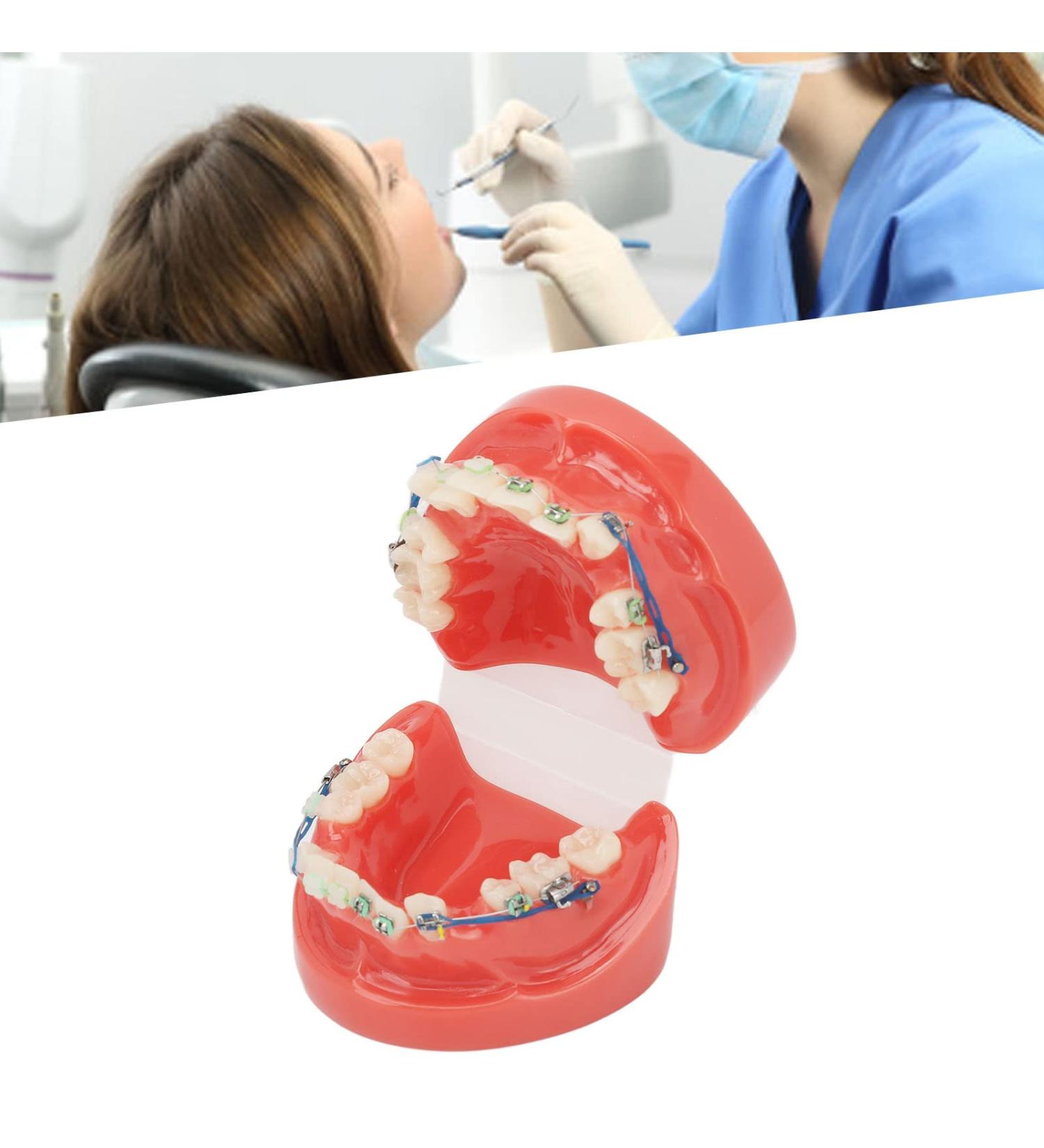 Buy GFRGFH Dental Model with 24 Teeth - Half Metal Half Ceramic Bracket for Teaching & Study - International Shipping Available - Buy Online on GoSupps.com