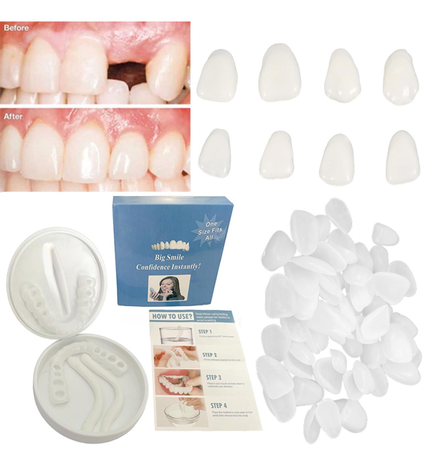 Buy Fake Tooth Repair Kits | Fix Missing & Broken Teeth | Moldable Thermal Beads Replacement - Buy Online on GoSupps.com
