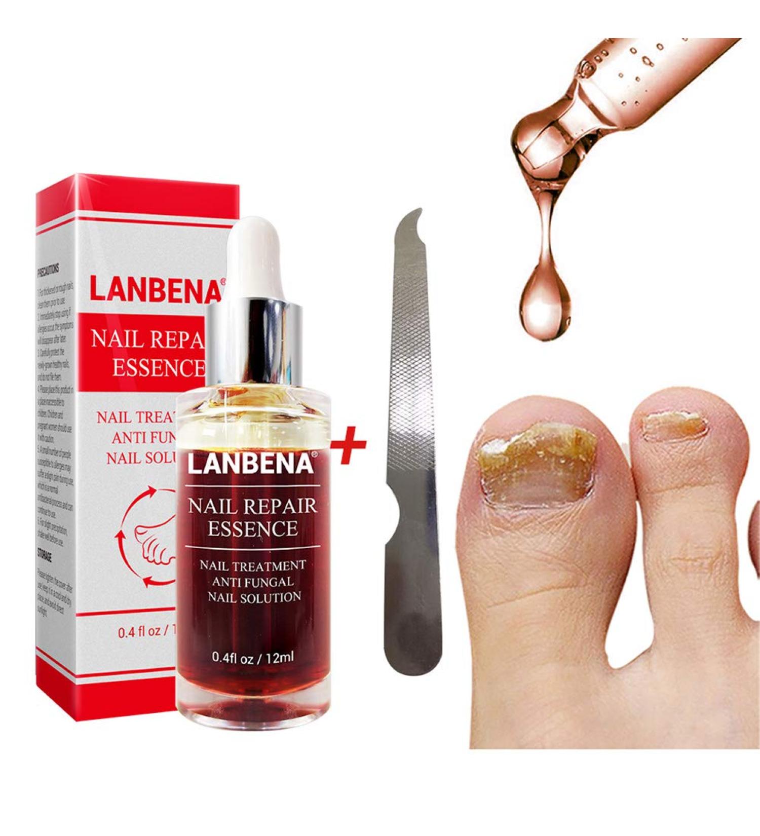 Beito 1PC Nail Repairs Solution de renouvellement des ongles l'huile essentielle tue les ongles fongiques Traitement fongique pour ongles cassants et craquel s (12ML) - Buy Online on GoSupps.com