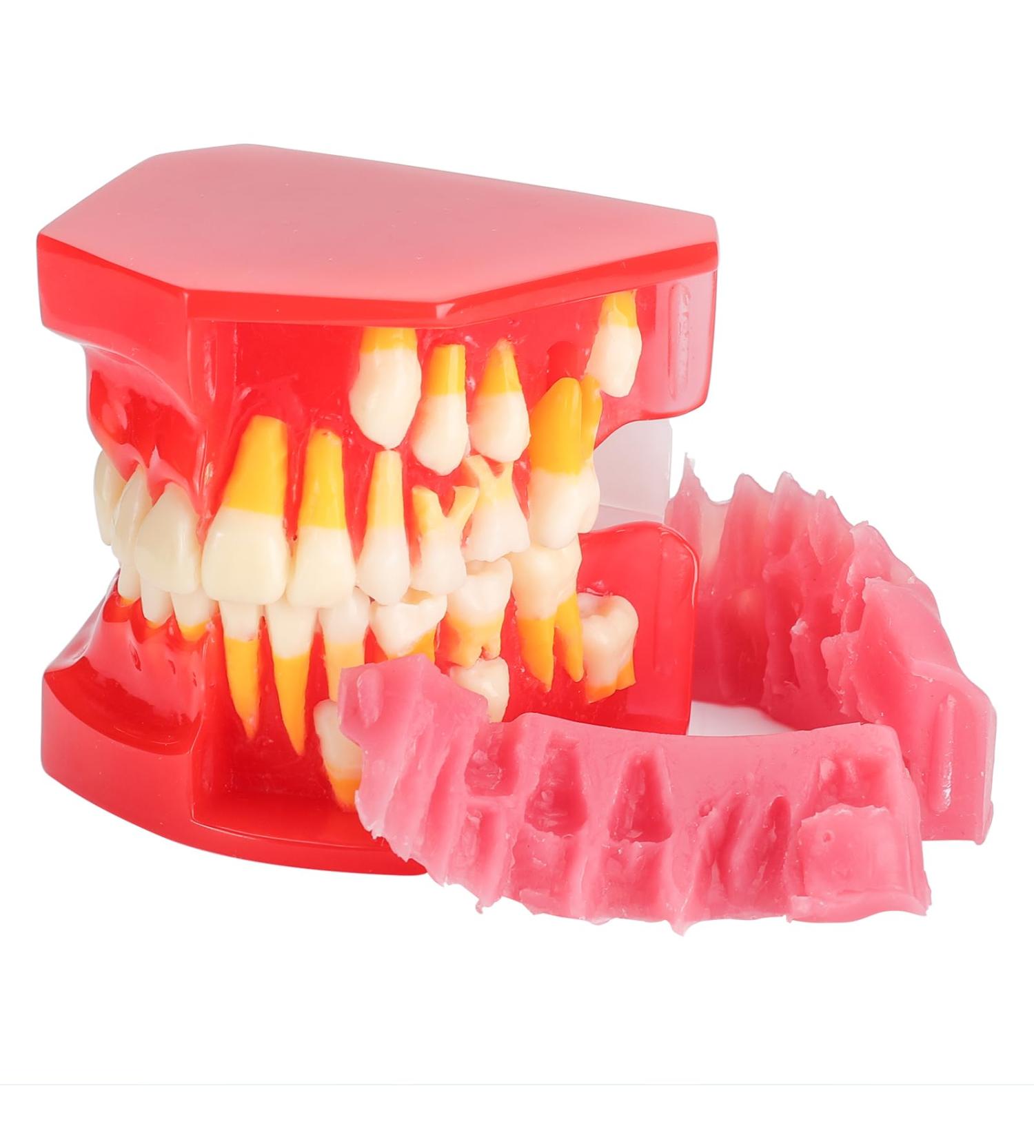 Teeth Eruption Development Model | Visualize Deciduous to Permanent Teeth Transition | International Shipping Available - Buy Online on GoSupps.com