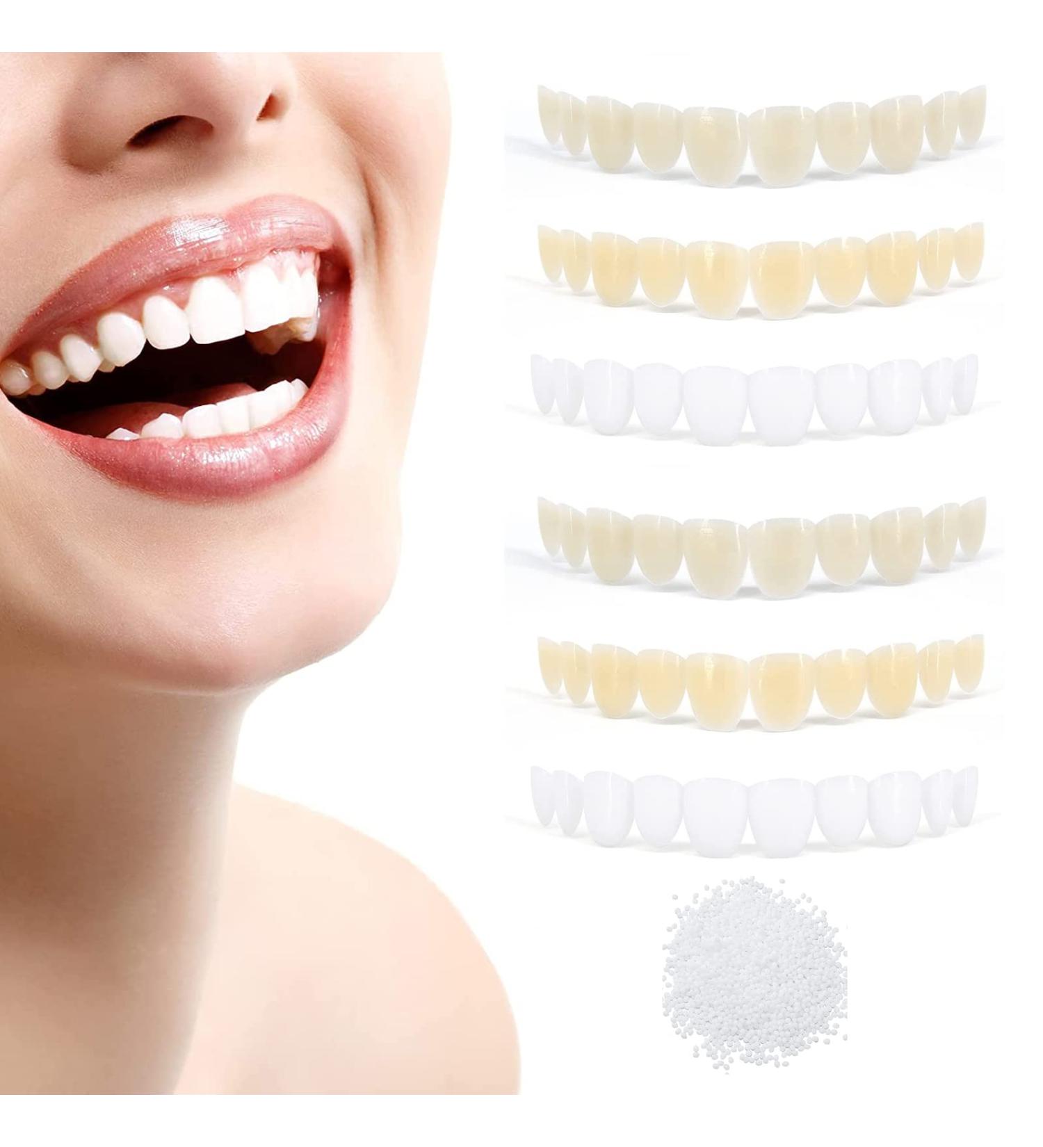 Temporary Tooth Repair Kit - 6PCS Fake Teeth Filling for Fixing Missing & Broken Tooth - Natural Shade - Buy Online on GoSupps.com