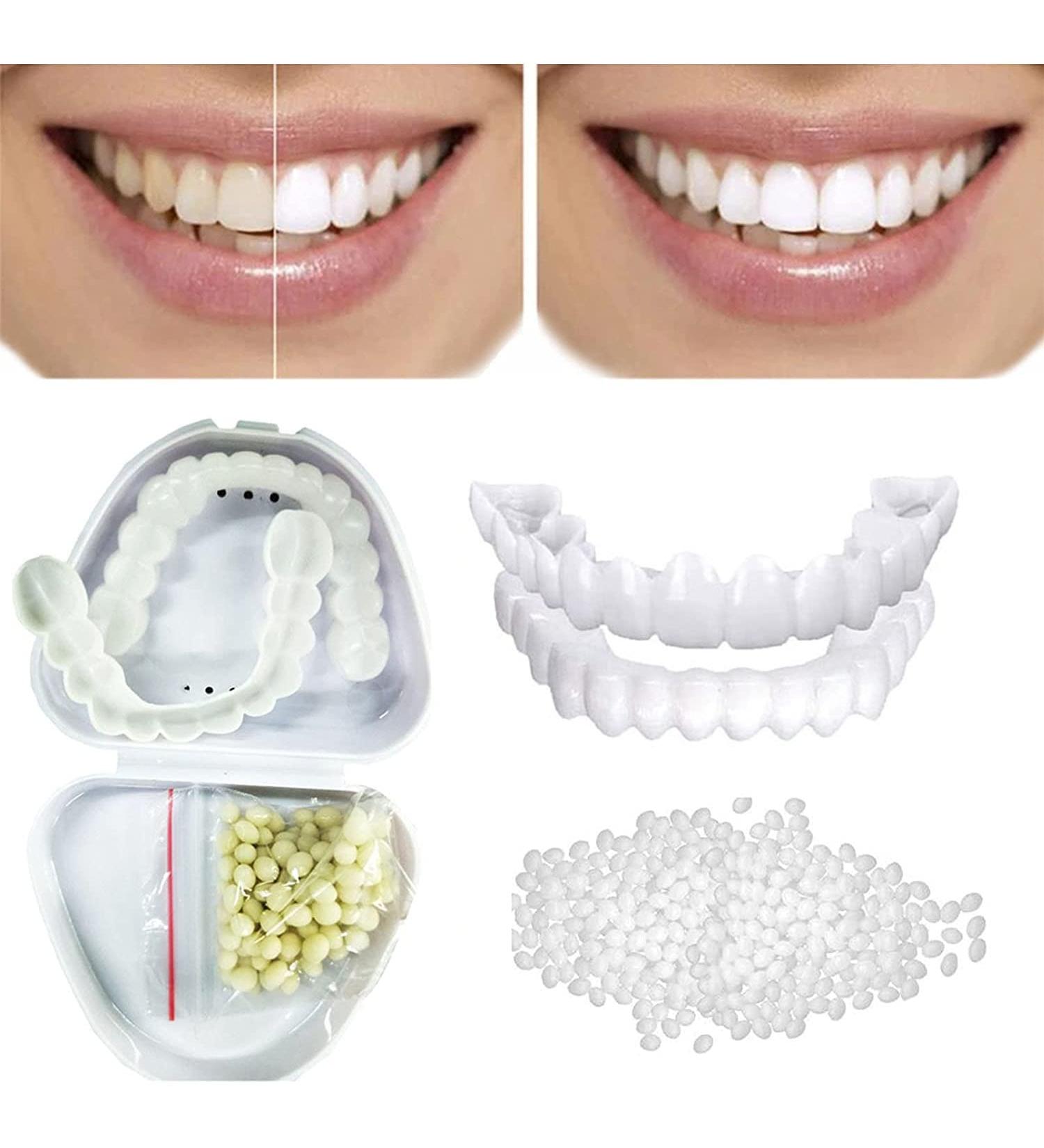 2 Pair Cosmetic Veneers - Temporary Upper & Lower Teeth for a Perfect Smile | Snap-On Prosthesis for Beautiful White Teeth - Buy Online on GoSupps.com