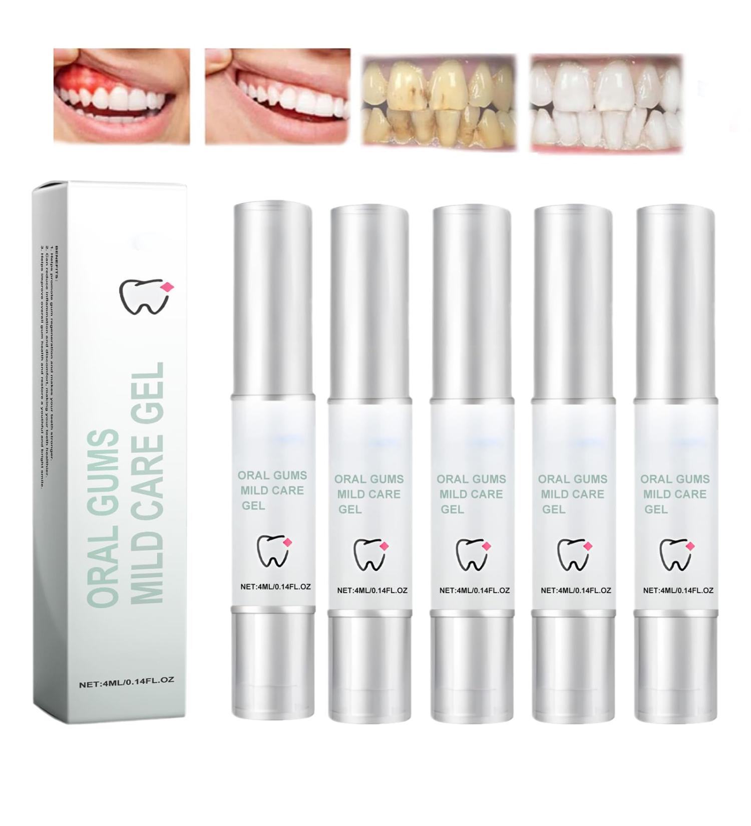 Buy Neslemy Oral Gum Treatment Gel (5pcs) - Effective Gum Protection Therapy for Healthy Gums | International Shipping Available - Buy Online on GoSupps.com