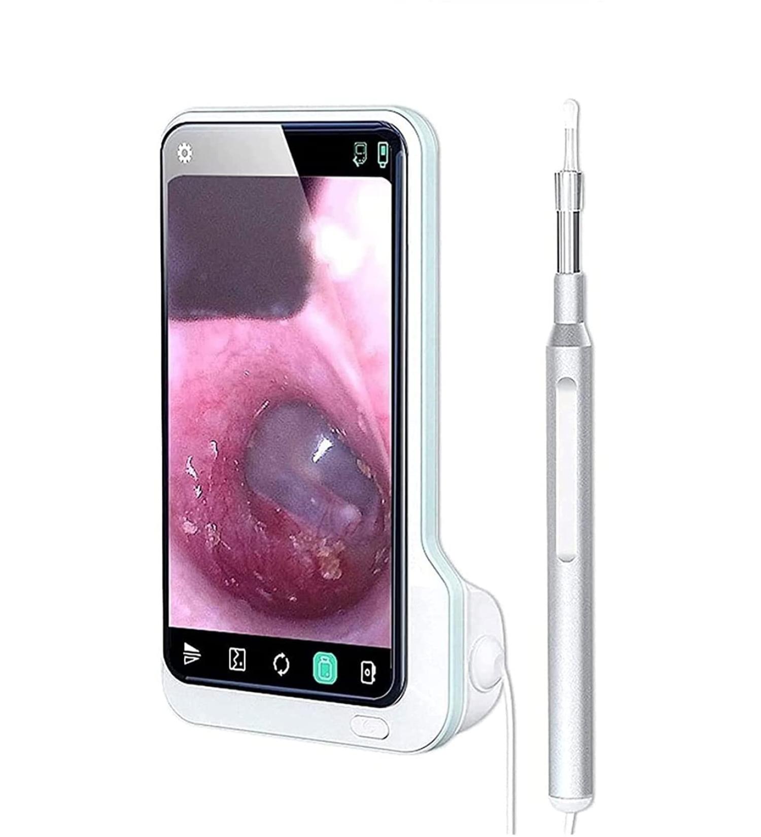 KouRy Multifunction Ear Wax Removal Tool Camera Smart Visual Ear Cleaner 1296P FHD Wireless Ear Otoscope with 6 LED Lights IP67 Waterproof WiFi Ear Cleaning Kit - Buy Online on GoSupps.com