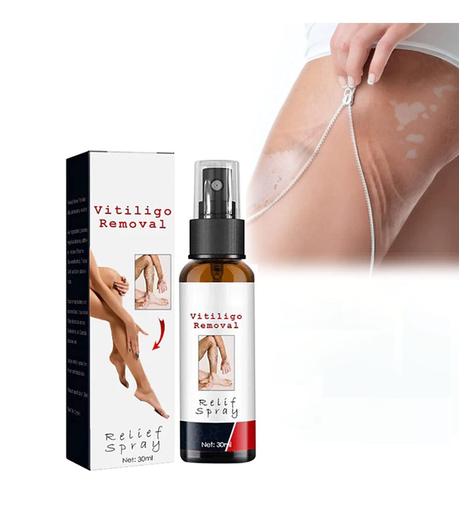 Vitiligo Removal Relief Spray - Skin Repair & Treatment for White Spots - Vitiligo Care Spray (1Pcs) - Buy Online on GoSupps.com