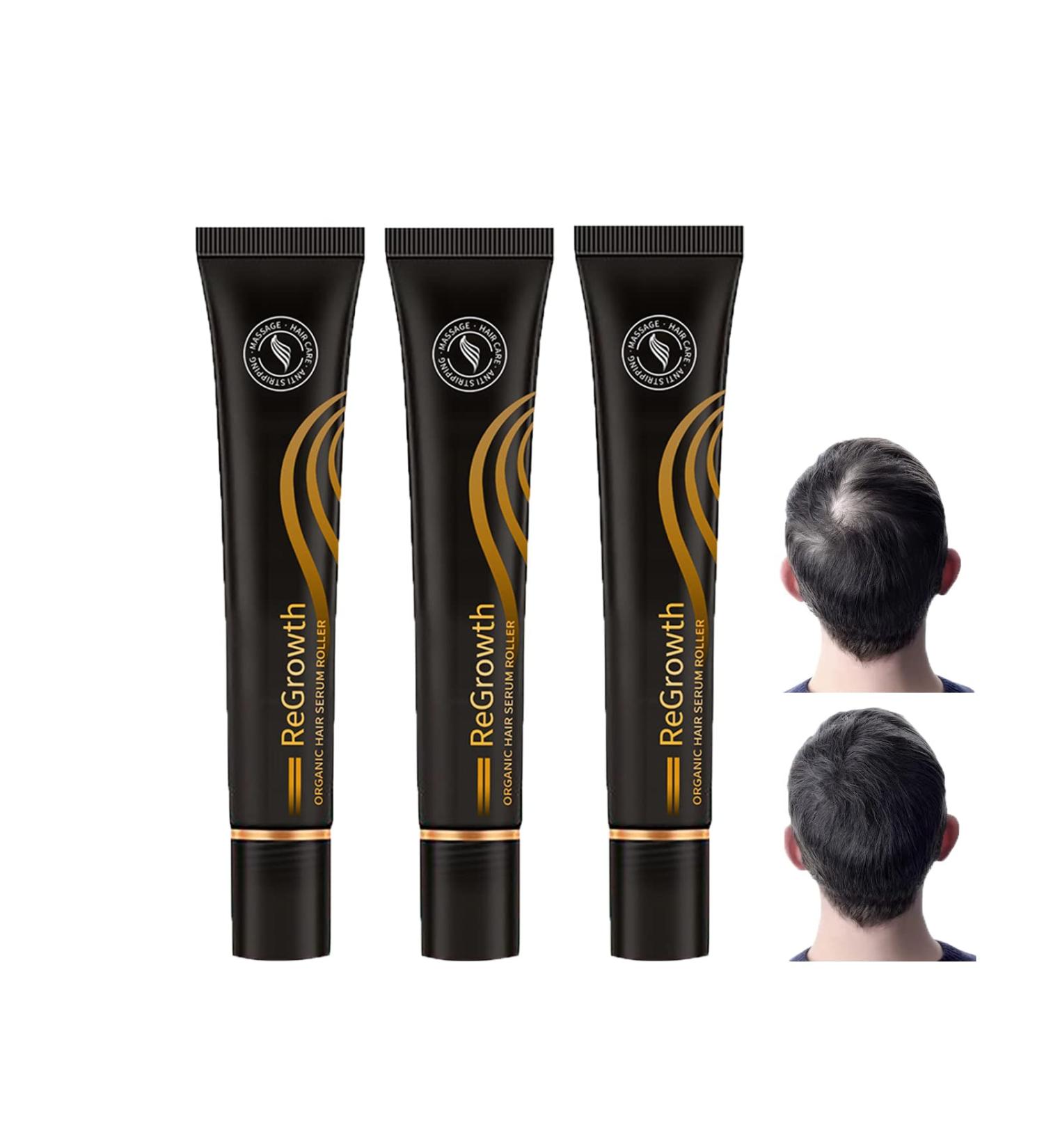 Hocossy Regrowth Organic Hair Serum Roller Set - Scalp Intense Hair Growth Treatment for Men & Women 20ml 3PCs - Natural Hair Care Solution - Buy Online on GoSupps.com