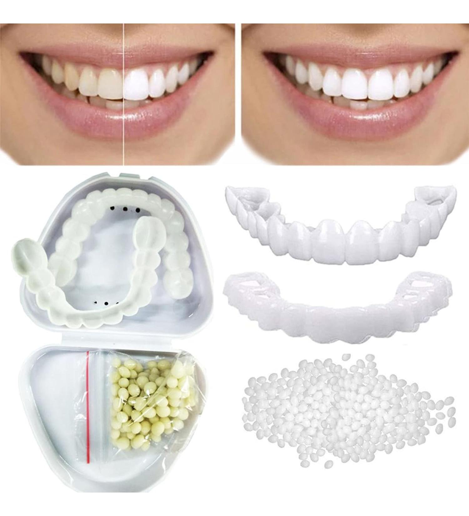 Dazzluxe Temporary Cosmetic Veneers - 2 Pairs for Instant Tooth Whitening | Artificial Teeth for Men & Women - Buy Online on GoSupps.com
