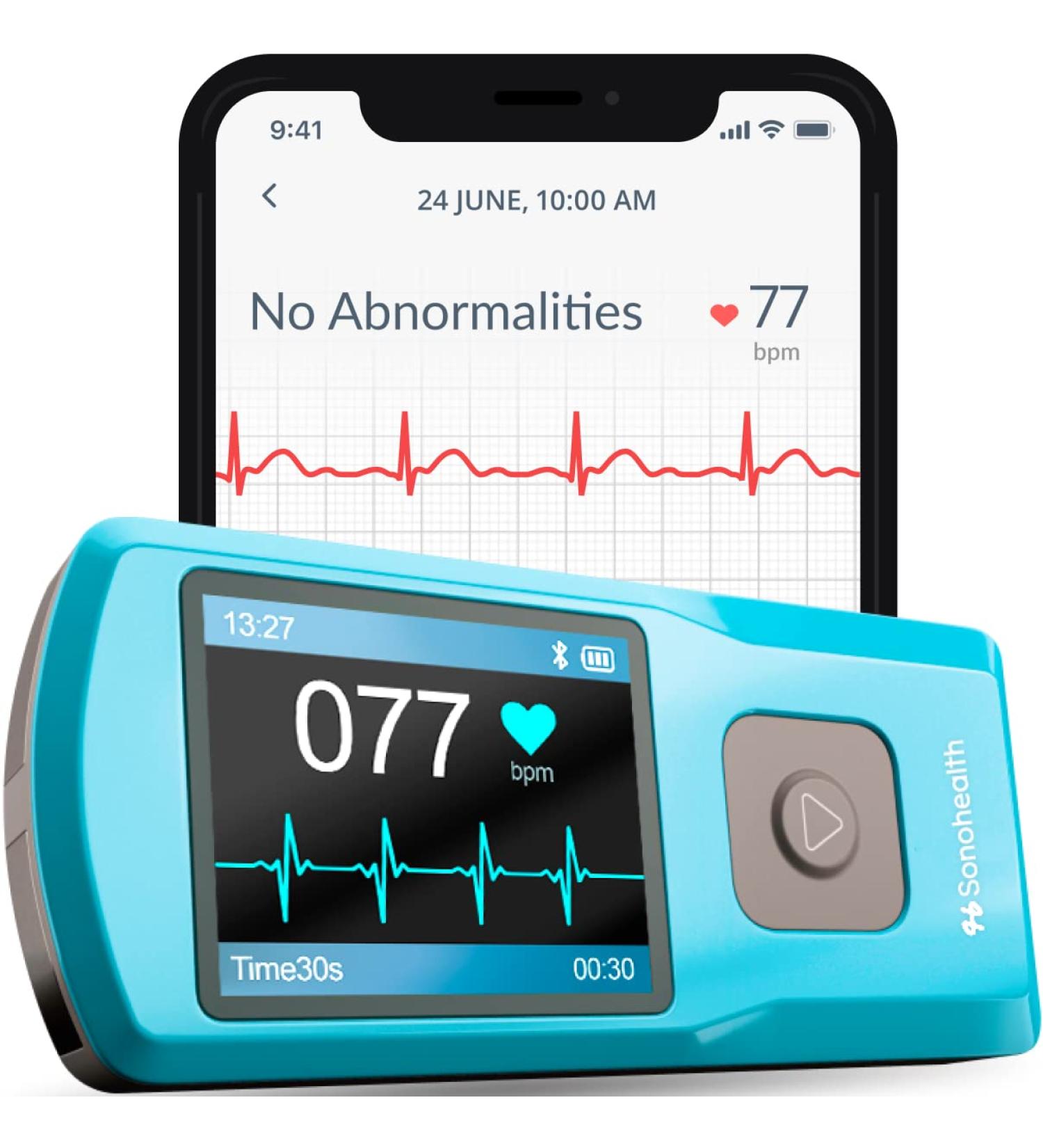 EKG Monitoring Device by Sonohealth - Portable Heart Rate Monitor: Cardia Mobile - Fingertip Touch - Multiple Lead ECG Electrocardiogram - Arrhythmia & PVC Detection - Standalone or with Mobile App - Buy Online on GoSupps.com