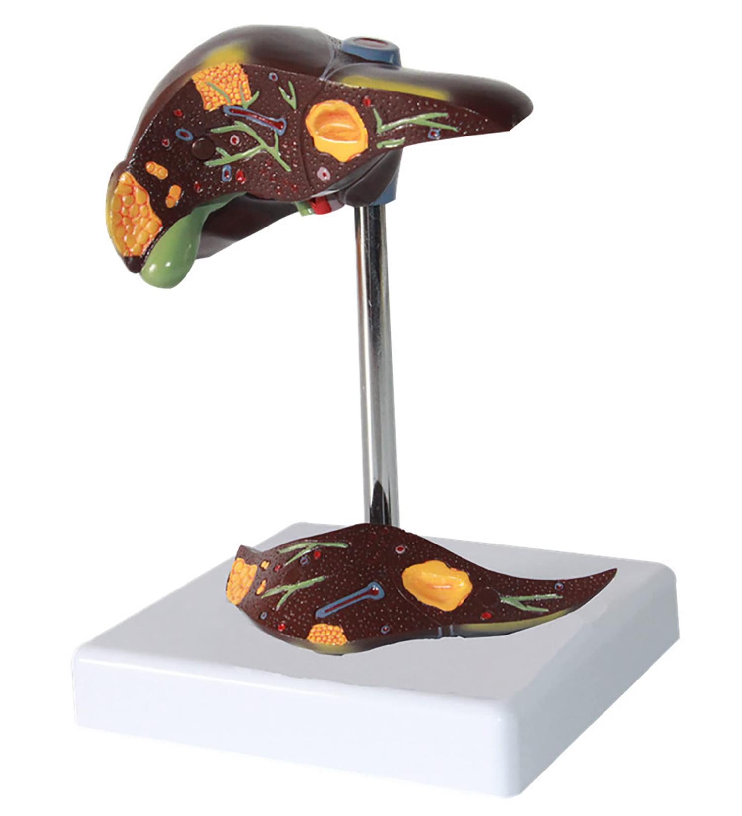 Life Size Human Liver Anatomical Model PVC Liver Pathology Model Disease Model for Human Body Mode for School - Buy Online on GoSupps.com
