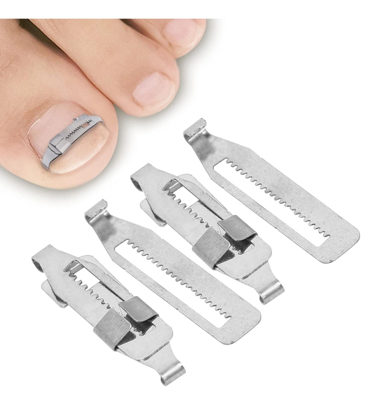 2PCS Ingrown Toenail Corrector Stainless Steel Paronychia Correction Tool with 2 Replacement Corrector for Effective Pain Relief for Toenail Correction - Buy Online on GoSupps.com