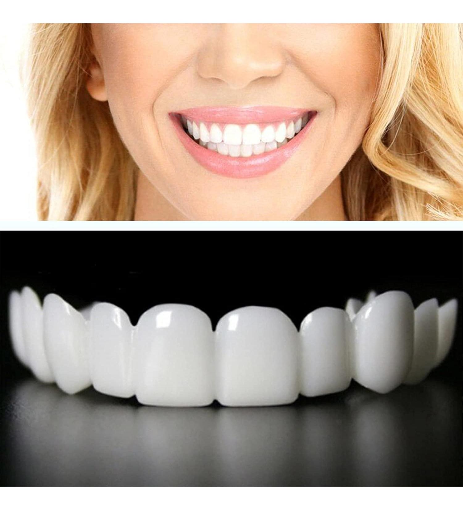 Flipped Warm Veneers - Top & Bottom Artificial Teeth for Instant Smile Makeover | Temporary Whitening Dentures for Men & Women - Buy Online on GoSupps.com