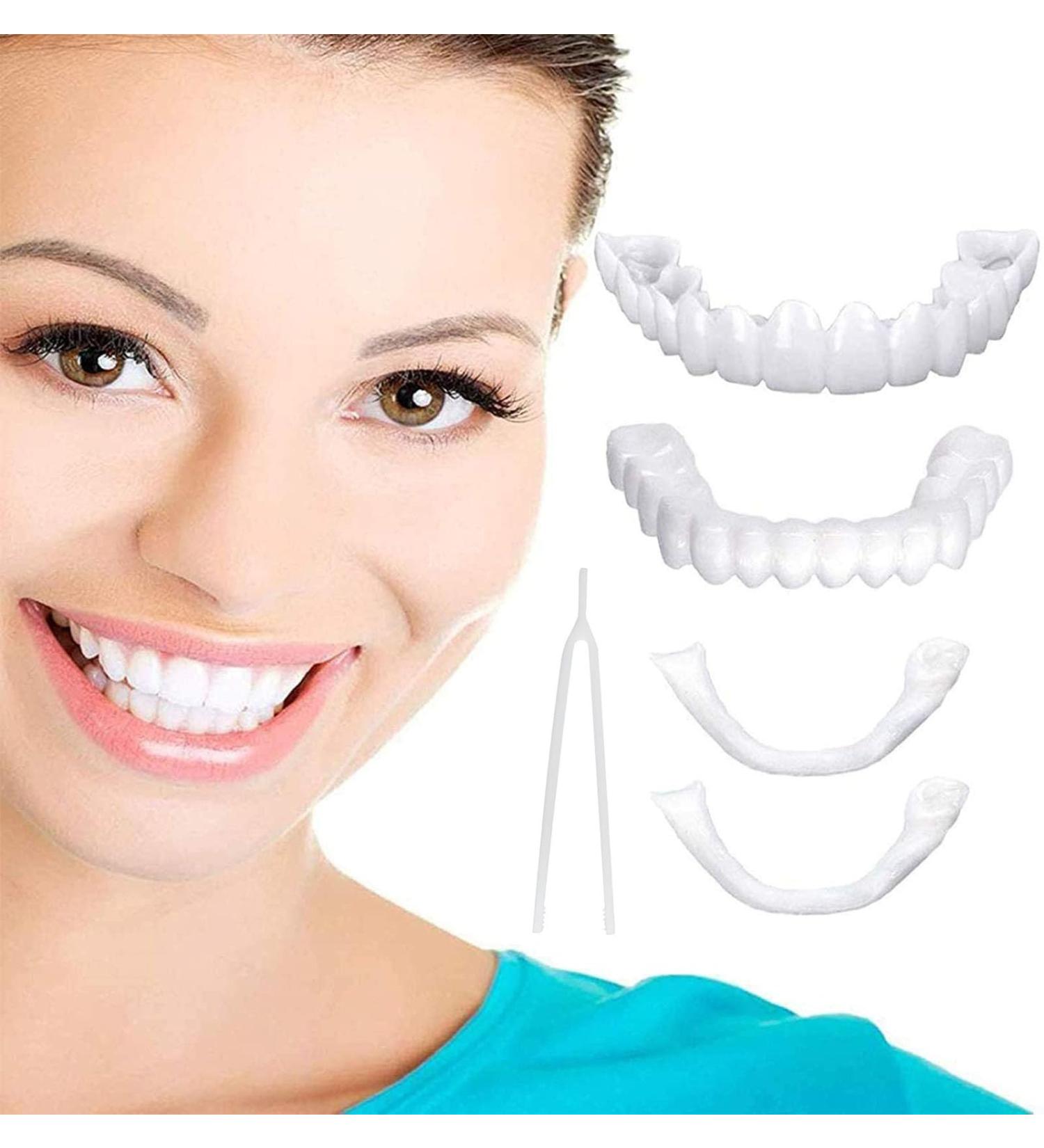 Brigtviee Cosmetic Veneers Set - Top & Bottom Teeth Lightening Dentures for Instant Smile Confidence - Perfect for Men & Women - 2 Pairs - Buy Online on GoSupps.com